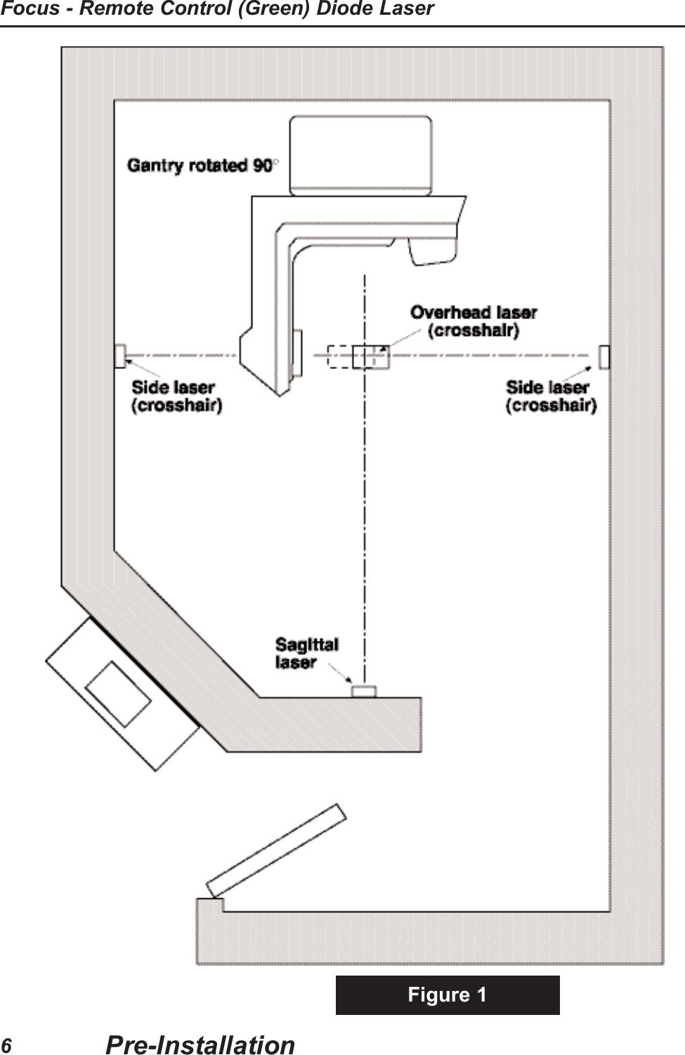 Figure 1Pre-InstallationFocus - Remote Control (Green) Diode Laser6
