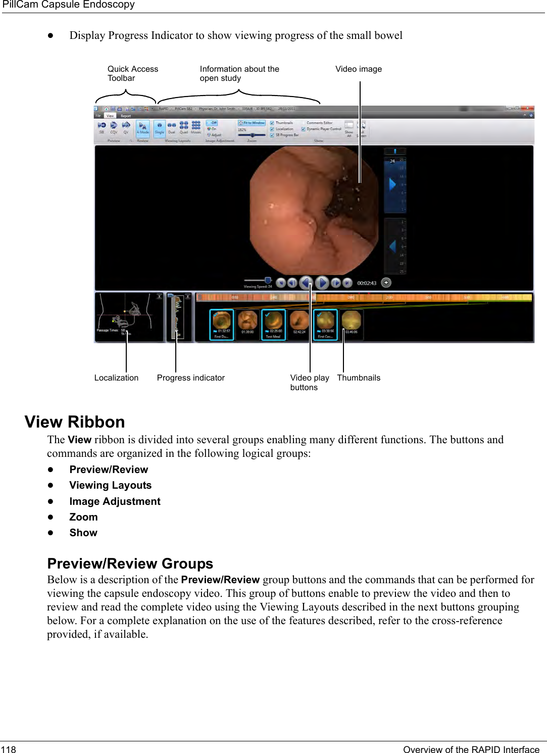 PillCam Capsule Endoscopy118 Overview of the RAPID Interface•Display Progress Indicator to show viewing progress of the small bowelView RibbonThe View ribbon is divided into several groups enabling many different functions. The buttons and commands are organized in the following logical groups:•Preview/Review•Viewing Layouts•Image Adjustment•Zoom•ShowPreview/Review GroupsBelow is a description of the Preview/Review group buttons and the commands that can be performed for viewing the capsule endoscopy video. This group of buttons enable to preview the video and then to review and read the complete video using the Viewing Layouts described in the next buttons grouping below. For a complete explanation on the use of the features described, refer to the cross-reference provided, if available. Information about the open studyQuick Access ToolbarVideo imageVideo play buttonsLocalization Progress indicator Thumbnails