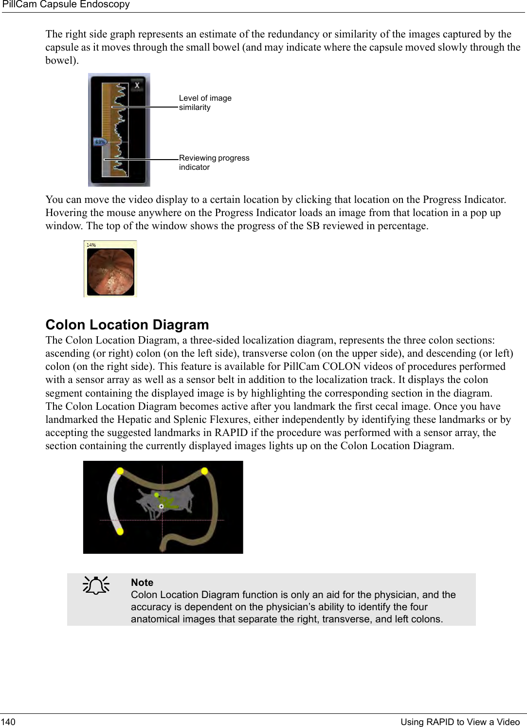 PillCam Capsule Endoscopy140 Using RAPID to View a VideoThe right side graph represents an estimate of the redundancy or similarity of the images captured by the capsule as it moves through the small bowel (and may indicate where the capsule moved slowly through the bowel). You can move the video display to a certain location by clicking that location on the Progress Indicator. Hovering the mouse anywhere on the Progress Indicator loads an image from that location in a pop up window. The top of the window shows the progress of the SB reviewed in percentage. Colon Location DiagramThe Colon Location Diagram, a three-sided localization diagram, represents the three colon sections: ascending (or right) colon (on the left side), transverse colon (on the upper side), and descending (or left) colon (on the right side). This feature is available for PillCam COLON videos of procedures performed with a sensor array as well as a sensor belt in addition to the localization track. It displays the colon segment containing the displayed image is by highlighting the corresponding section in the diagram. The Colon Location Diagram becomes active after you landmark the first cecal image. Once you have landmarked the Hepatic and Splenic Flexures, either independently by identifying these landmarks or by accepting the suggested landmarks in RAPID if the procedure was performed with a sensor array, the section containing the currently displayed images lights up on the Colon Location Diagram.֠֠֠֠NoteColon Location Diagram function is only an aid for the physician, and the accuracy is dependent on the physician’s ability to identify the four anatomical images that separate the right, transverse, and left colons.Level of image similarityReviewing progress indicator