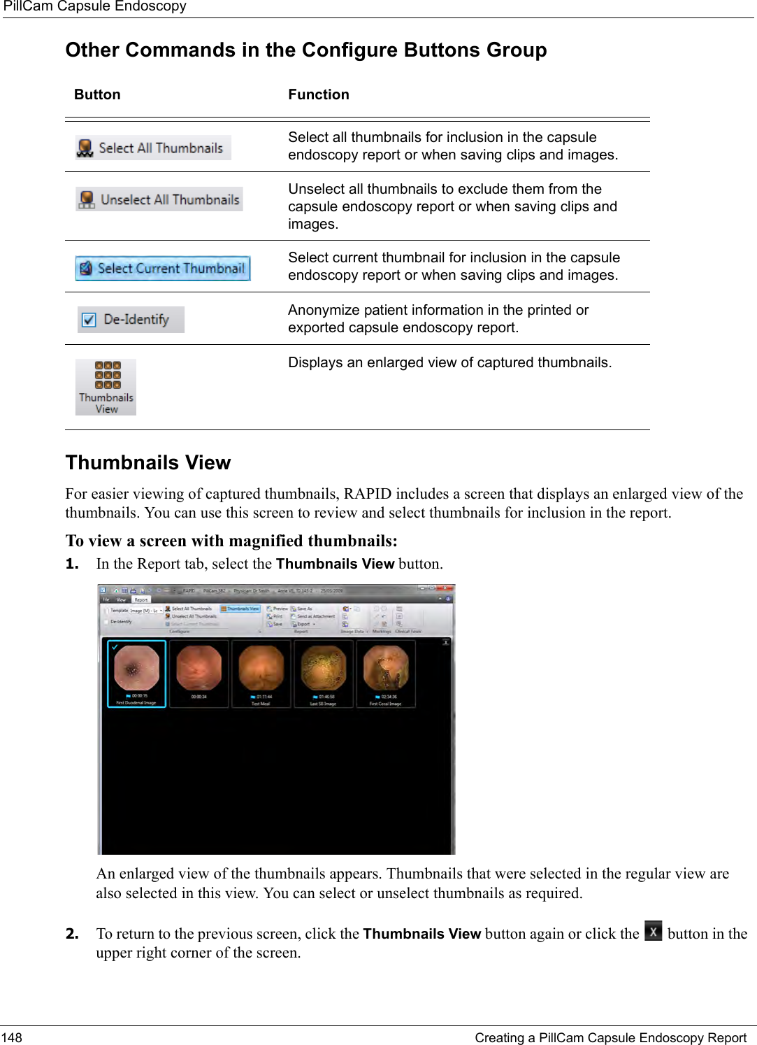 PillCam Capsule Endoscopy148 Creating a PillCam Capsule Endoscopy ReportOther Commands in the Configure Buttons Group Thumbnails ViewFor easier viewing of captured thumbnails, RAPID includes a screen that displays an enlarged view of the thumbnails. You can use this screen to review and select thumbnails for inclusion in the report.To view a screen with magnified thumbnails:1. In the Report tab, select the Thumbnails View button. An enlarged view of the thumbnails appears. Thumbnails that were selected in the regular view are also selected in this view. You can select or unselect thumbnails as required.2. To return to the previous screen, click the Thumbnails View button again or click the   button in the upper right corner of the screen.Button FunctionSelect all thumbnails for inclusion in the capsule endoscopy report or when saving clips and images.Unselect all thumbnails to exclude them from the capsule endoscopy report or when saving clips and images.Select current thumbnail for inclusion in the capsule endoscopy report or when saving clips and images.Anonymize patient information in the printed or exported capsule endoscopy report.Displays an enlarged view of captured thumbnails.