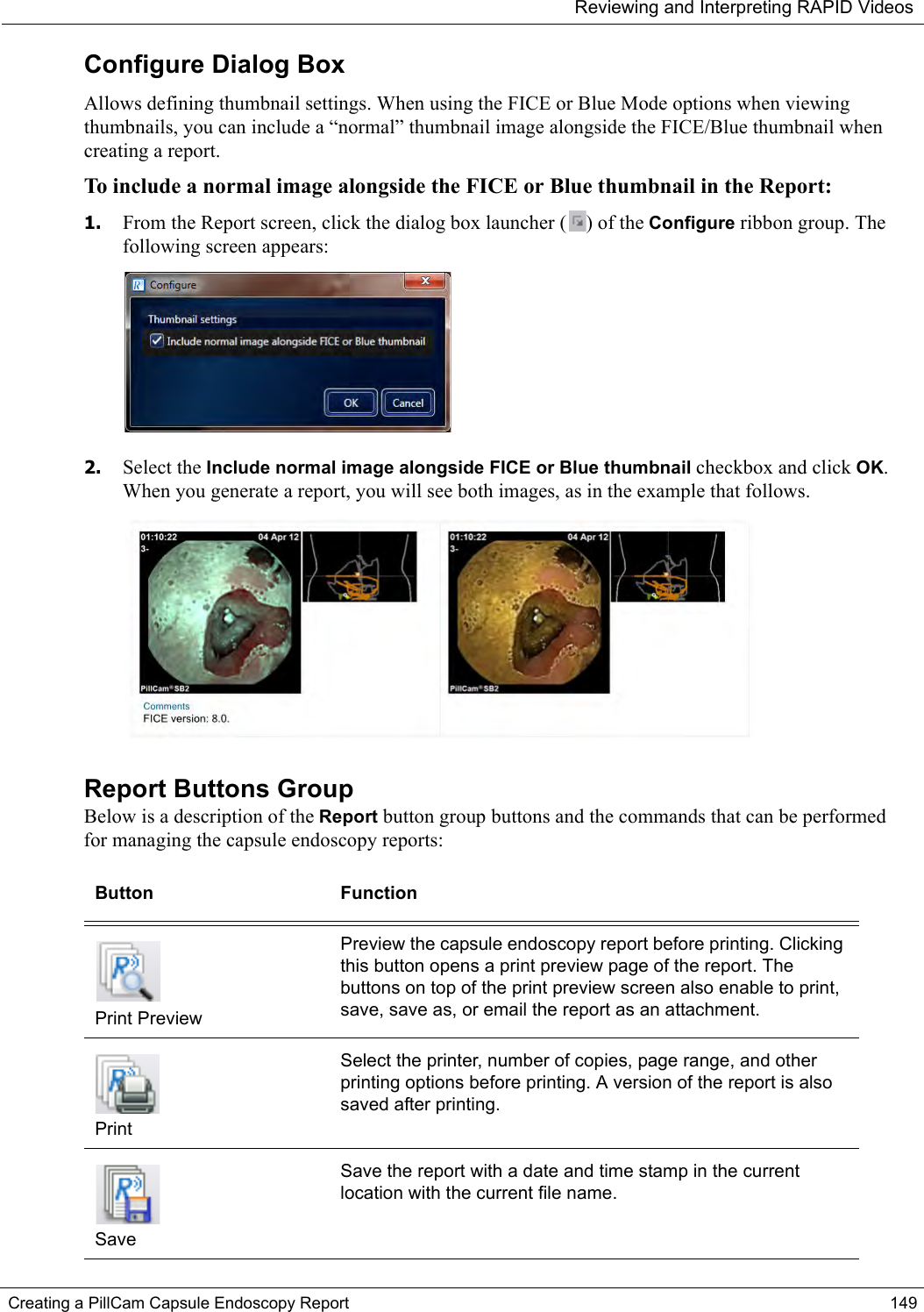 Reviewing and Interpreting RAPID VideosCreating a PillCam Capsule Endoscopy Report 149Configure Dialog BoxAllows defining thumbnail settings. When using the FICE or Blue Mode options when viewing thumbnails, you can include a “normal” thumbnail image alongside the FICE/Blue thumbnail when creating a report. To include a normal image alongside the FICE or Blue thumbnail in the Report:1. From the Report screen, click the dialog box launcher ( ) of the Configure ribbon group. The following screen appears:2. Select the Include normal image alongside FICE or Blue thumbnail checkbox and click OK. When you generate a report, you will see both images, as in the example that follows.Report Buttons GroupBelow is a description of the Report button group buttons and the commands that can be performed for managing the capsule endoscopy reports: Button FunctionPrint PreviewPreview the capsule endoscopy report before printing. Clicking this button opens a print preview page of the report. The buttons on top of the print preview screen also enable to print, save, save as, or email the report as an attachment. PrintSelect the printer, number of copies, page range, and other printing options before printing. A version of the report is also saved after printing.SaveSave the report with a date and time stamp in the current location with the current file name.