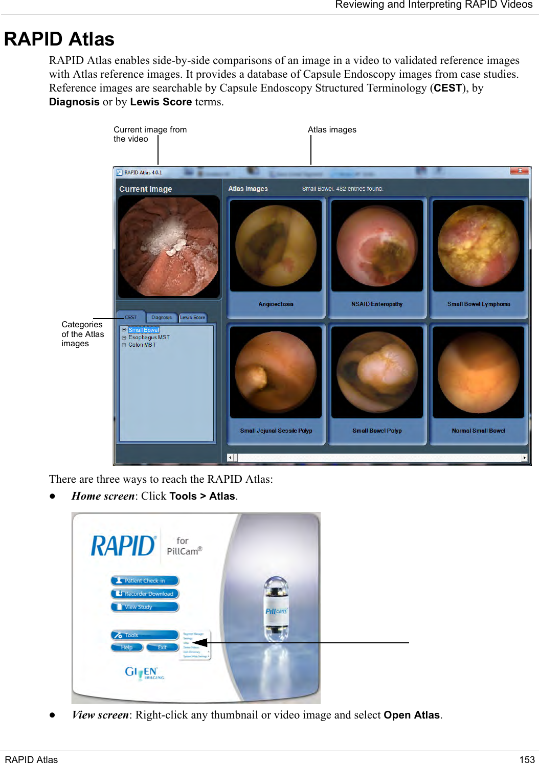 Reviewing and Interpreting RAPID VideosRAPID Atlas 153RAPID AtlasRAPID Atlas enables side-by-side comparisons of an image in a video to validated reference images with Atlas reference images. It provides a database of Capsule Endoscopy images from case studies. Reference images are searchable by Capsule Endoscopy Structured Terminology (CEST), by Diagnosis or by Lewis Score terms.There are three ways to reach the RAPID Atlas:•Home screen: Click Tools &gt; Atlas. •View screen: Right-click any thumbnail or video image and select Open Atlas.Current image from the videoAtlas images Categories of the Atlas images