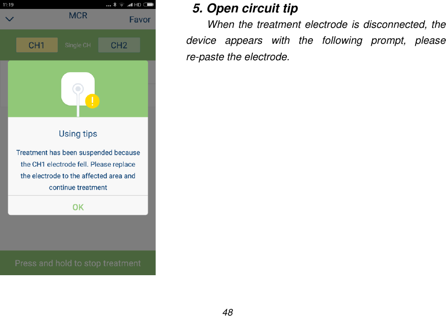 48    5. Open circuit tip When the treatment electrode is disconnected, the device  appears  with  the  following  prompt,  please re-paste the electrode. 