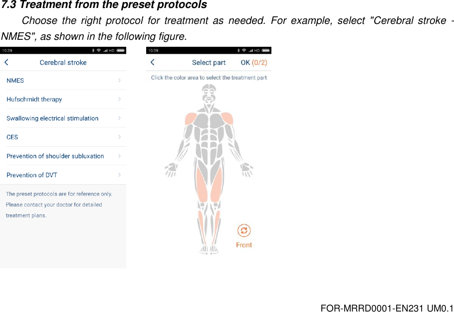 FOR-MRRD0001-EN231 UM0.1 7.3 Treatment from the preset protocols Choose  the  right  protocol  for  treatment  as  needed.  For  example,  select  "Cerebral  stroke  - NMES", as shown in the following figure.         