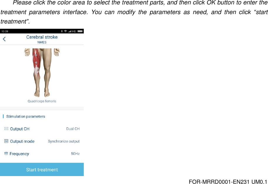 FOR-MRRD0001-EN231 UM0.1 Please click the color area to select the treatment parts, and then click OK button to enter the treatment  parameters  interface.  You  can  modify  the  parameters  as  need,  and  then  click  &ldquo;start treatment&rdquo;.  