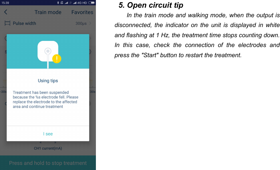 495. Open circuit tipIn the train mode and walking mode, when the output isdisconnected, the indicator on the unit is displayed in whiteand flashing at 1 Hz, the treatment time stops counting down.In this case, check the connection of the electrodes andpress the "Start" button to restart the treatment.