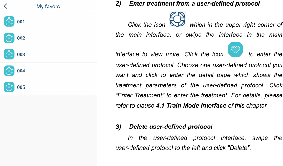 512) Enter treatment from a user-defined protocolClick the icon which in the upper right corner ofthe main interface, or swipe the interface in the maininterface to view more. Click the icon to enter theuser-defined protocol. Choose one user-defined protocol youwant and click to enter the detail page which shows thetreatment parameters of the user-defined protocol. Click&ldquo;Enter Treatment&rdquo; to enter the treatment. For details, pleaserefer to clause 4.1 Train Mode Interface of this chapter.3) Delete user-defined protocolIn the user-defined protocol interface, swipe theuser-defined protocol to the left and click "Delete".