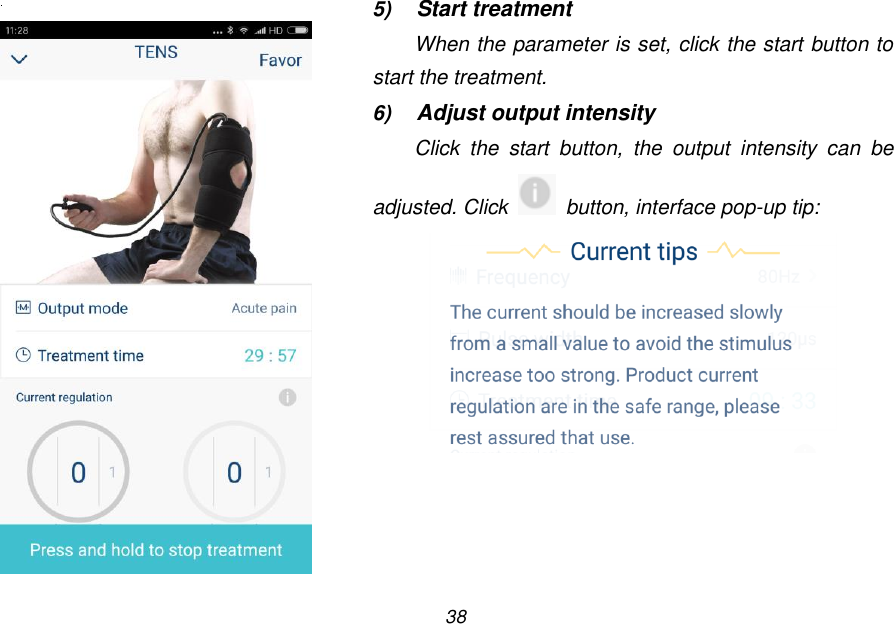 38    5) Start treatment When the parameter is set, click the start button to start the treatment. 6) Adjust output intensity Click  the  start  button,  the  output  intensity  can  be adjusted. Click    button, interface pop-up tip:  