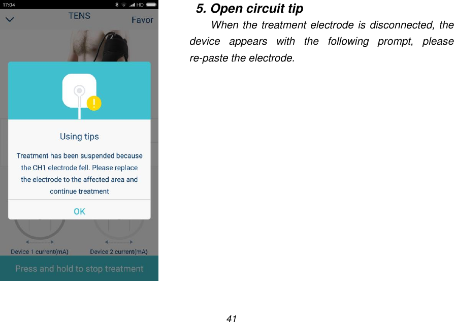 41    5. Open circuit tip When the treatment electrode is disconnected, the device  appears  with  the  following  prompt,  please re-paste the electrode. 