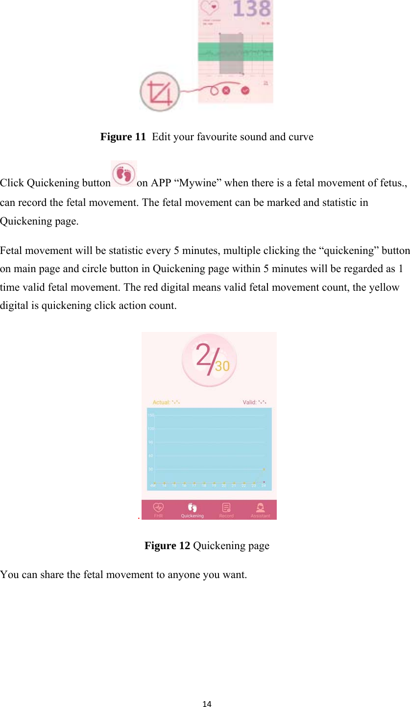 14 Figure 11  Edit your favourite sound and curve Click Quickening button on APP “Mywine” when there is a fetal movement of fetus., can record the fetal movement. The fetal movement can be marked and statistic in Quickening page. Fetal movement will be statistic every 5 minutes, multiple clicking the “quickening” button on main page and circle button in Quickening page within 5 minutes will be regarded as 1 time valid fetal movement. The red digital means valid fetal movement count, the yellow digital is quickening click action count. . Figure 12 Quickening page You can share the fetal movement to anyone you want.     