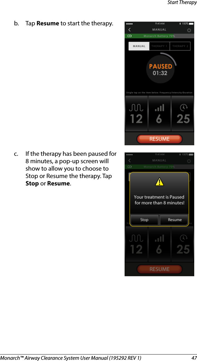 Monarch™ Airway Clearance System User Manual (195292 REV 1)  47Start Therapyb. Tap Resume to start the therapy.c. If the therapy has been paused for 8 minutes, a pop-up screen will show to allow you to choose to Stop or Resume the therapy. Tap Stop or Resume.