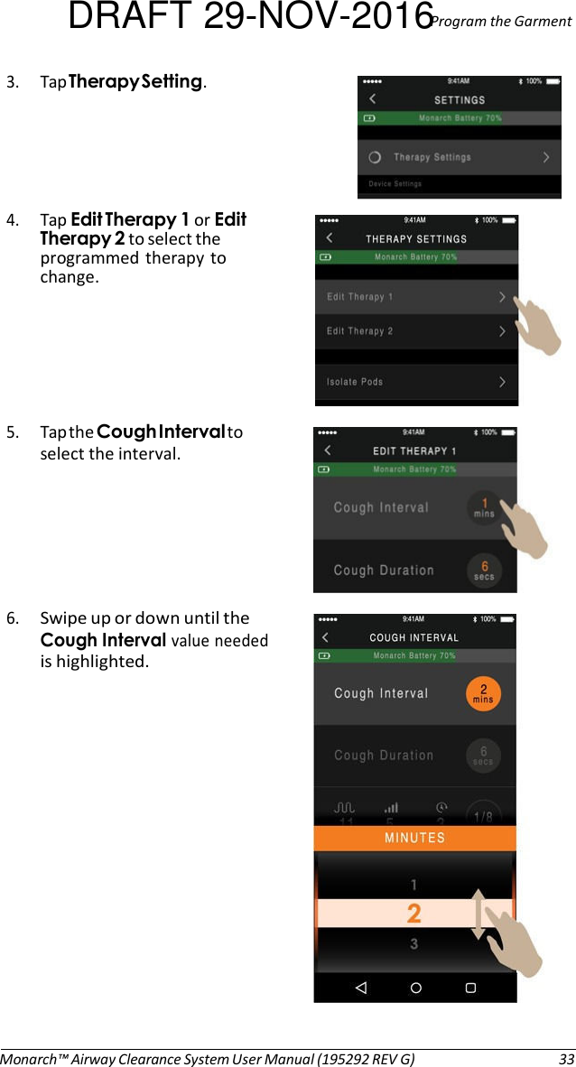 DRAFT 29-NOV-2016Program the Garment 3. Tap Therapy Setting.   4. Tap Edit Therapy 1 or Edit Therapy 2 to select the programmed therapy to change.       5. Tap the Cough Interval to select the interval.       6. Swipe up or down until the Cough Interval value needed is highlighted.                  Monarch™ Airway Clearance System User Manual (195292 REV G)  33 