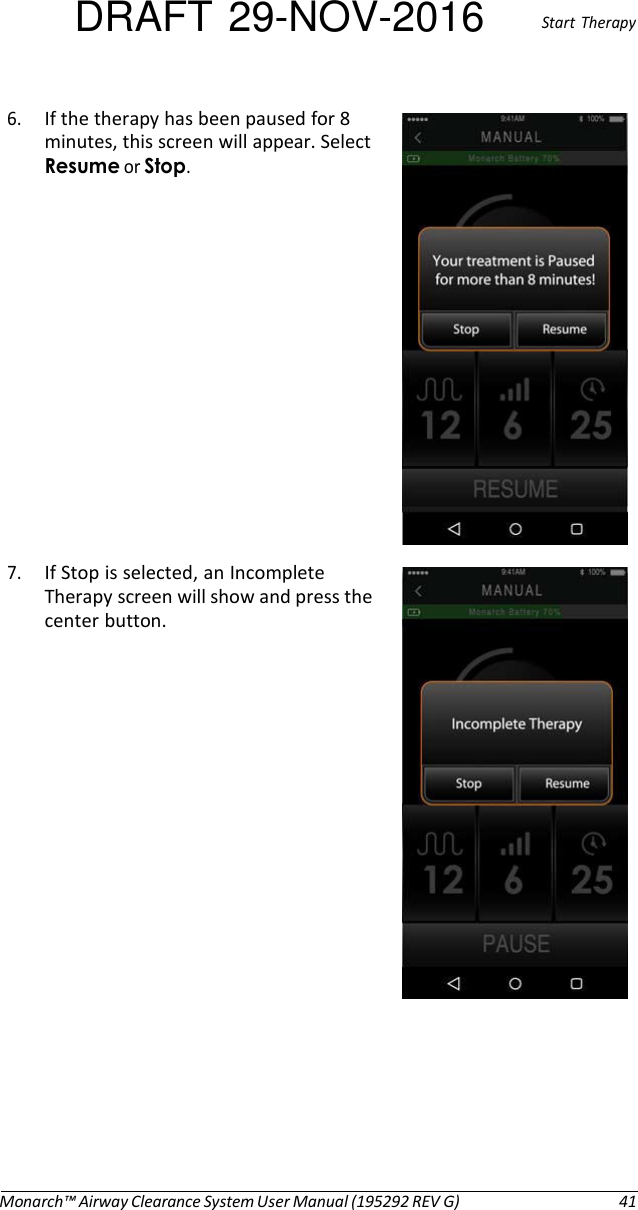 DRAFT 29-NOV-2016  Start  Therapy  6. If the therapy has been paused for 8 minutes, this screen will appear. Select Resume or Stop.                7. If Stop is selected, an Incomplete Therapy screen will show and press the center button.                        Monarch™ Airway Clearance System User Manual (195292 REV G)  41 