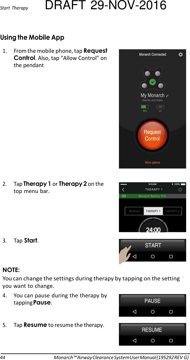 Start  Therapy DRAFT 29-NOV-2016  Using the Mobile App 1. From the mobile phone, tap Request Control. Also, tap “Allow Control” on the pendant                2. Tap Therapy 1 or Therapy 2 on the top menu bar.      3. Tap Start.  NOTE: You can change the settings during therapy by tapping on the setting you want to change. 4. You can pause during the therapy by tapping Pause.   5. Tap Resume to resume the therapy.     44 Monarch™ Airway Clearance System User Manual (195292 REV G) 