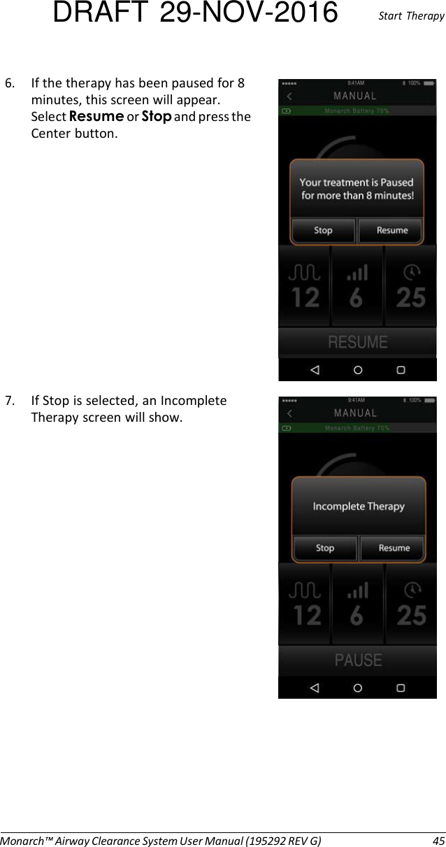 DRAFT 29-NOV-2016  Start  Therapy  6. If the therapy has been paused for 8 minutes, this screen will appear. Select Resume or Stop and press the Center button.               7. If Stop is selected, an Incomplete Therapy screen will show.                         Monarch™ Airway Clearance System User Manual (195292 REV G)  45 