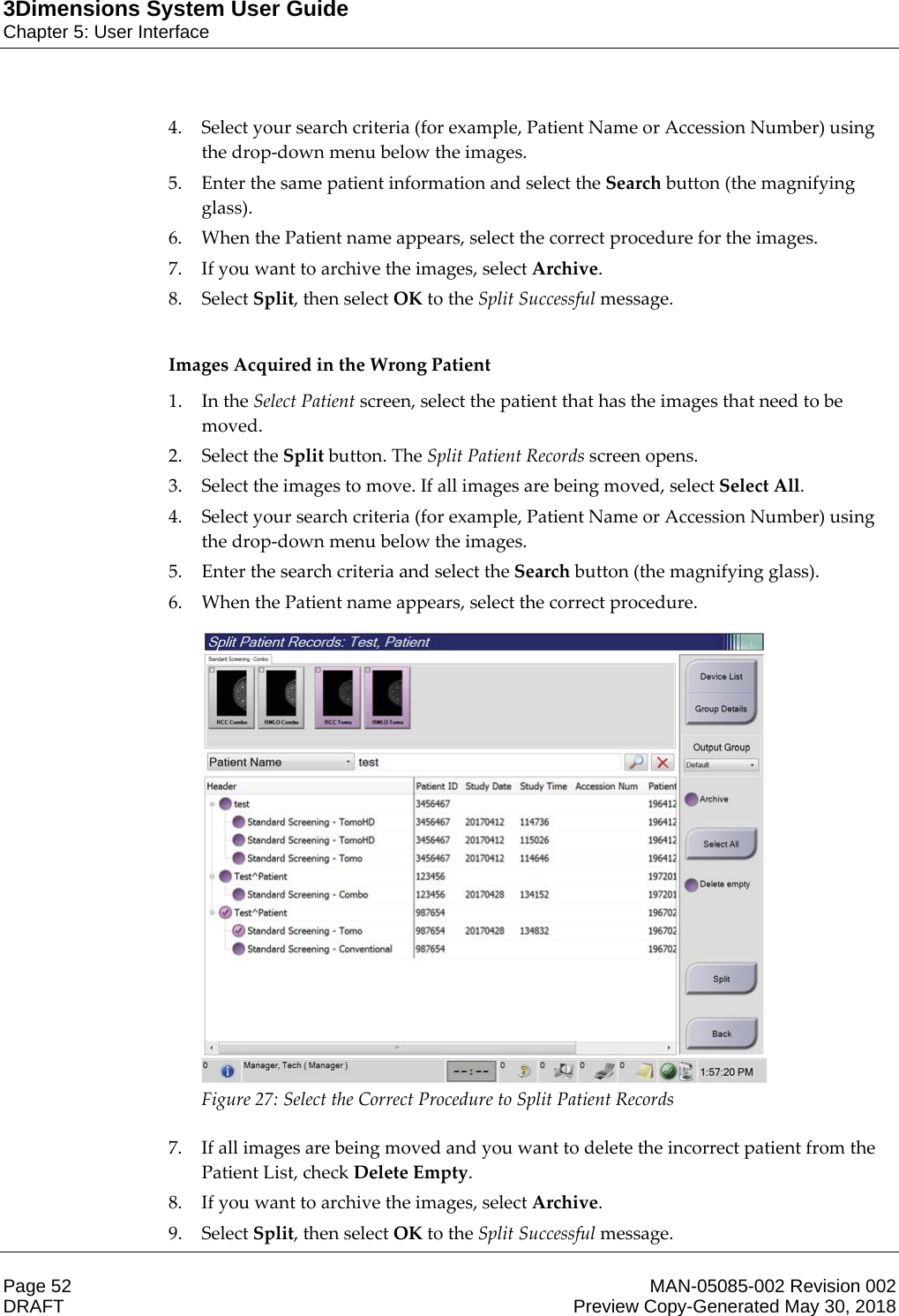 3Dimensions System User GuideChapter 5: User InterfacePage 52 MAN-05085-002 Revision 002  DRAFT Preview Copy-Generated May 30, 20184. Select your search criteria (for example, Patient Name or Accession Number) using the drop-down menu below the images. 5. Enter the same patient information and select the Search button (the magnifying glass). 6. When the Patient name appears, select the correct procedure for the images. 7. If you want to archive the images, select Archive. 8. Select Split, then select OK to the Split Successful message.  Images Acquired in the Wrong Patient 1. In the Select Patient screen, select the patient that has the images that need to be moved. 2. Select the Split button. The Split Patient Records screen opens. 3. Select the images to move. If all images are being moved, select Select All. 4. Select your search criteria (for example, Patient Name or Accession Number) using the drop-down menu below the images. 5. Enter the search criteria and select the Search button (the magnifying glass). 6. When the Patient name appears, select the correct procedure.  Figure 27: Select the Correct Procedure to Split Patient Records    7. If all images are being moved and you want to delete the incorrect patient from the Patient List, check Delete Empty. 8. If you want to archive the images, select Archive. 9. Select Split, then select OK to the Split Successful message. 
