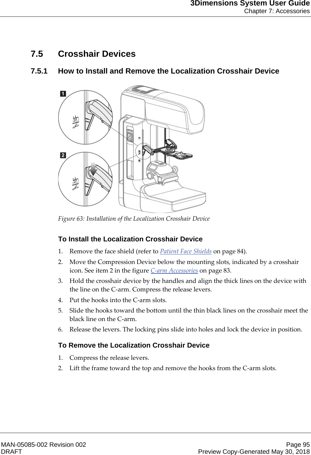 3Dimensions System User GuideChapter 7: AccessoriesMAN-05085-002 Revision 002 Page 95DRAFT Preview Copy-Generated May 30, 20187.5 Crosshair Devices7.5.1 How to Install and Remove the Localization Crosshair Device  Figure 63: Installation of the Localization Crosshair Device    To Install the Localization Crosshair Device1. Remove the face shield (refer to Patient Face Shields on page 84). 2. Move the Compression Device below the mounting slots, indicated by a crosshair icon. See item 2 in the figure C-arm Accessories on page 83. 3. Hold the crosshair device by the handles and align the thick lines on the device with the line on the C-arm. Compress the release levers. 4. Put the hooks into the C-arm slots. 5. Slide the hooks toward the bottom until the thin black lines on the crosshair meet the black line on the C-arm. 6. Release the levers. The locking pins slide into holes and lock the device in position. To Remove the Localization Crosshair Device1. Compress the release levers. 2. Lift the frame toward the top and remove the hooks from the C-arm slots. 