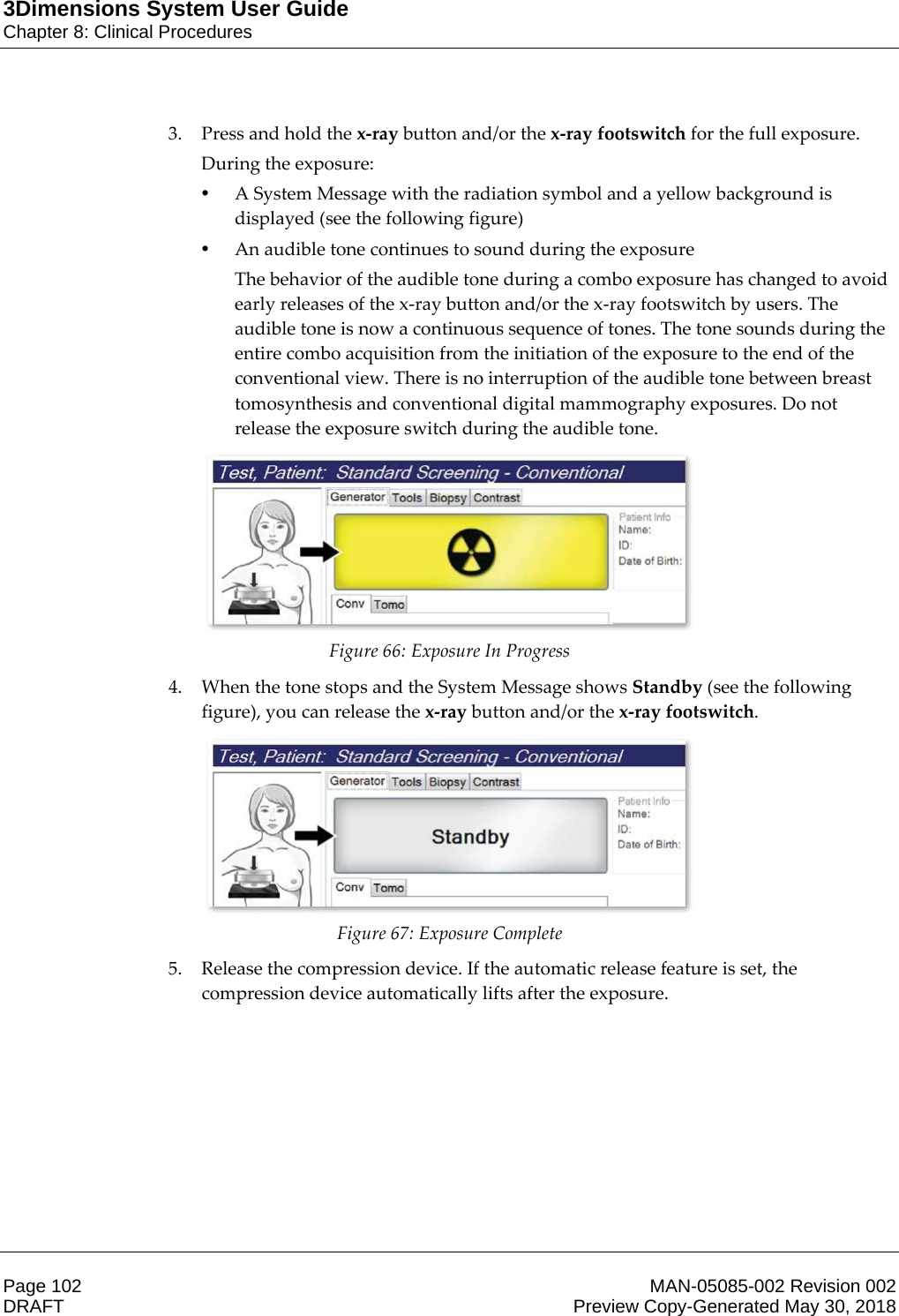 3Dimensions System User GuideChapter 8: Clinical ProceduresPage 102 MAN-05085-002 Revision 002  DRAFT Preview Copy-Generated May 30, 20183. Press and hold the x-ray button and/or the x-ray footswitch for the full exposure.  During the exposure: •A System Message with the radiation symbol and a yellow background is displayed (see the following figure) •An audible tone continues to sound during the exposure The behavior of the audible tone during a combo exposure has changed to avoid early releases of the x-ray button and/or the x-ray footswitch by users. The audible tone is now a continuous sequence of tones. The tone sounds during the entire combo acquisition from the initiation of the exposure to the end of the conventional view. There is no interruption of the audible tone between breast tomosynthesis and conventional digital mammography exposures. Do not release the exposure switch during the audible tone.  Figure 66: Exposure In Progress 4. When the tone stops and the System Message shows Standby (see the following figure), you can release the x-ray button and/or the x-ray footswitch.  Figure 67: Exposure Complete 5. Release the compression device. If the automatic release feature is set, the compression device automatically lifts after the exposure.  