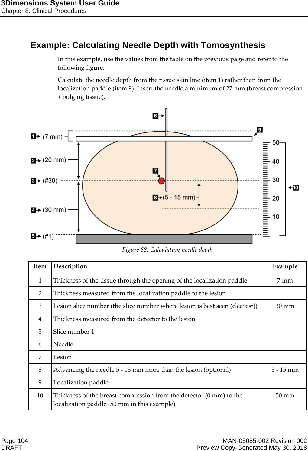 3Dimensions System User GuideChapter 8: Clinical ProceduresPage 104 MAN-05085-002 Revision 002  DRAFT Preview Copy-Generated May 30, 2018Example: Calculating Needle Depth with TomosynthesisIn this example, use the values from the table on the previous page and refer to the following figure. Calculate the needle depth from the tissue skin line (item 1) rather than from the localization paddle (item 9). Insert the needle a minimum of 27 mm (breast compression + bulging tissue).  Figure 68: Calculating needle depth    Item Description  Example 1  Thickness of the tissue through the opening of the localization paddle  7 mm 2  Thickness measured from the localization paddle to the lesion   3  Lesion slice number (the slice number where lesion is best seen (clearest))  30 mm 4  Thickness measured from the detector to the lesion   5 Slice number 1   6 Needle   7 Lesion   8  Advancing the needle 5 - 15 mm more than the lesion (optional)  5 - 15 mm 9 Localization paddle   10  Thickness of the breast compression from the detector (0 mm) to the localization paddle (50 mm in this example) 50 mm    