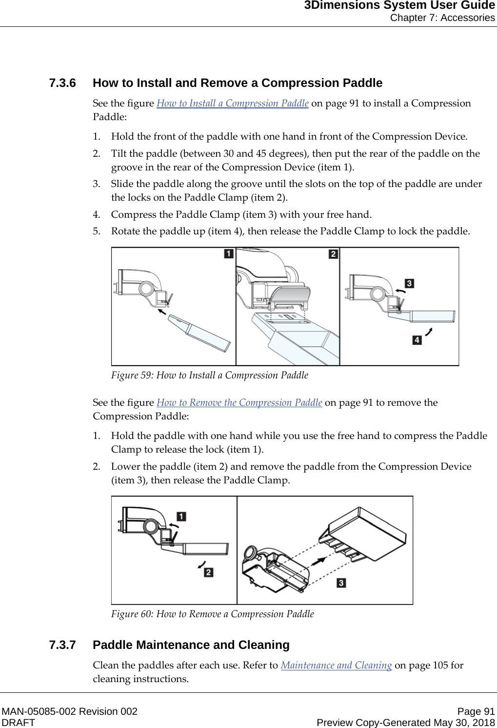 3Dimensions System User GuideChapter 7: AccessoriesMAN-05085-002 Revision 002 Page 91DRAFT Preview Copy-Generated May 30, 20187.3.6 How to Install and Remove a Compression PaddleSee the figure How to Install a Compression Paddle on page 91 to install a Compression Paddle: 1. Hold the front of the paddle with one hand in front of the Compression Device. 2. Tilt the paddle (between 30 and 45 degrees), then put the rear of the paddle on the groove in the rear of the Compression Device (item 1). 3. Slide the paddle along the groove until the slots on the top of the paddle are under the locks on the Paddle Clamp (item 2). 4. Compress the Paddle Clamp (item 3) with your free hand. 5. Rotate the paddle up (item 4), then release the Paddle Clamp to lock the paddle.  Figure 59: How to Install a Compression Paddle    See the figure How to Remove the Compression Paddle on page 91 to remove the Compression Paddle: 1. Hold the paddle with one hand while you use the free hand to compress the Paddle Clamp to release the lock (item 1). 2. Lower the paddle (item 2) and remove the paddle from the Compression Device (item 3), then release the Paddle Clamp.  Figure 60: How to Remove a Compression Paddle    7.3.7 Paddle Maintenance and CleaningClean the paddles after each use. Refer to Maintenance and Cleaning on page 105 for cleaning instructions. 