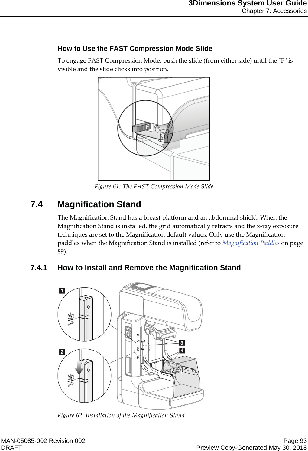 3Dimensions System User GuideChapter 7: AccessoriesMAN-05085-002 Revision 002 Page 93DRAFT Preview Copy-Generated May 30, 2018How to Use the FAST Compression Mode SlideTo engage FAST Compression Mode, push the slide (from either side) until the &quot;F&quot; is visible and the slide clicks into position.  Figure 61: The FAST Compression Mode Slide 7.4 Magnification StandThe Magnification Stand has a breast platform and an abdominal shield. When the Magnification Stand is installed, the grid automatically retracts and the x-ray exposure techniques are set to the Magnification default values. Only use the Magnification paddles when the Magnification Stand is installed (refer to Magnification Paddles on page 89). 7.4.1 How to Install and Remove the Magnification Stand  Figure 62: Installation of the Magnification Stand    