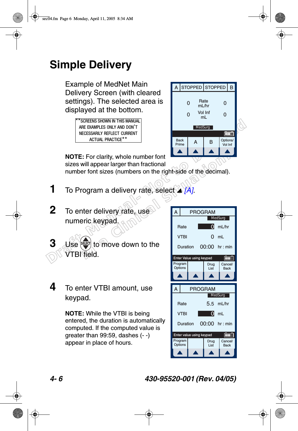 Draft Manual- Not to be usedin a Clinical Situation.4- 6 430-95520-001 (Rev. 04/05) Simple DeliveryExample of MedNet Main Delivery Screen (with cleared settings). The selected area is displayed at the bottom.NOTE: For clarity, whole number font sizes will appear larger than fractional number font sizes (numbers on the right-side of the decimal).1To Program a delivery rate, select  [A].2To enter delivery rate, use numeric keypad.3Use   to move down to the VTBI field.4To enter VTBI amount, use keypad.NOTE: While the VTBI is being entered, the duration is automatically computed. If the computed value is greater than 99:59, dashes (- -) appear in place of hours.AABBSTOPPED STOPPEDRatemL/hrVol InfmLOptions/Vol InfBackPrime0000MedSurg**SCREENS SHOWN IN THIS MANUAL ARE EXAMPLES ONLY AND DON’T NECESSARILY REFLECT CURRENT ACTUAL PRACTICE**APROGRAMRateVTBIDurationmL/hrmLhr : minProgramOptionsCancel/BackDrug ListEnter Value using keypad0000:00MedSurgAPROGRAMRateVTBIDurationmL/hrmLhr : minProgramOptionsCancel/BackDrug ListEnter value using keypad5.5000:00MedSurgsec04.fm  Page 6  Monday, April 11, 2005  8:34 AM