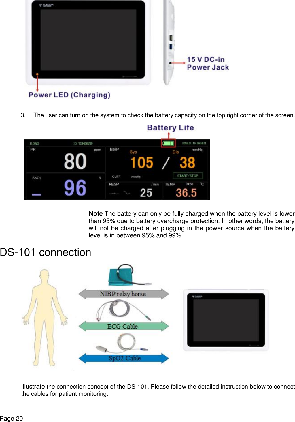    Page 20   3. The user can turn on the system to check the battery capacity on the top right corner of the screen.   Note The battery can only be fully charged when the battery level is lower than 95% due to battery overcharge protection. In other words, the battery will not be charged after plugging in the power source when the battery level is in between 95% and 99%. DS-101 connection   Illustrate the connection concept of the DS-101. Please follow the detailed instruction below to connect the cables for patient monitoring. 