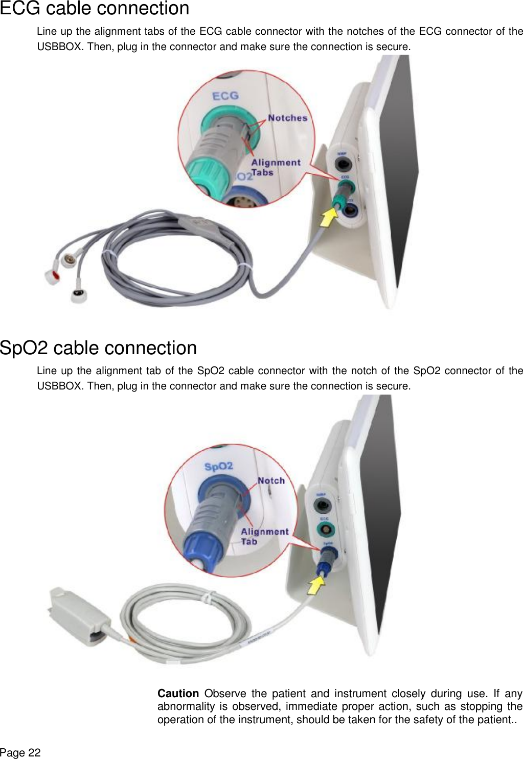    Page 22 ECG cable connection Line up the alignment tabs of the ECG cable connector with the notches of the ECG connector of the USBBOX. Then, plug in the connector and make sure the connection is secure.    SpO2 cable connection Line up the alignment tab of the SpO2 cable connector with the notch of the SpO2 connector of the USBBOX. Then, plug in the connector and make sure the connection is secure.   Caution Observe the patient and instrument closely during use. If any abnormality is observed, immediate proper action, such as stopping the operation of the instrument, should be taken for the safety of the patient.. 