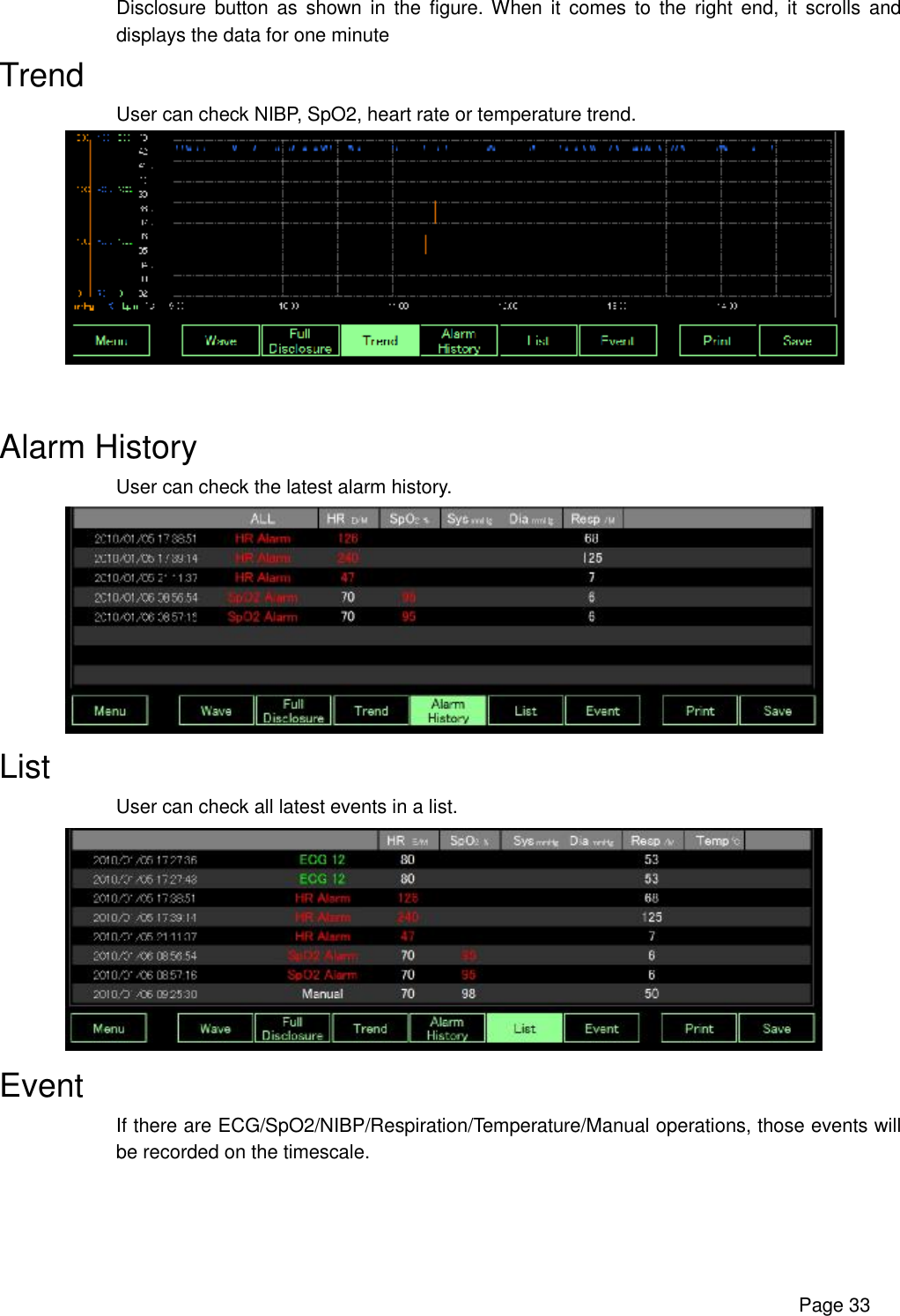     Page 33 Disclosure button as shown in the figure. When it comes to the right end, it scrolls and displays the data for one minute Trend   User can check NIBP, SpO2, heart rate or temperature trend.    Alarm History User can check the latest alarm history.  List User can check all latest events in a list.  Event If there are ECG/SpO2/NIBP/Respiration/Temperature/Manual operations, those events will be recorded on the timescale. 