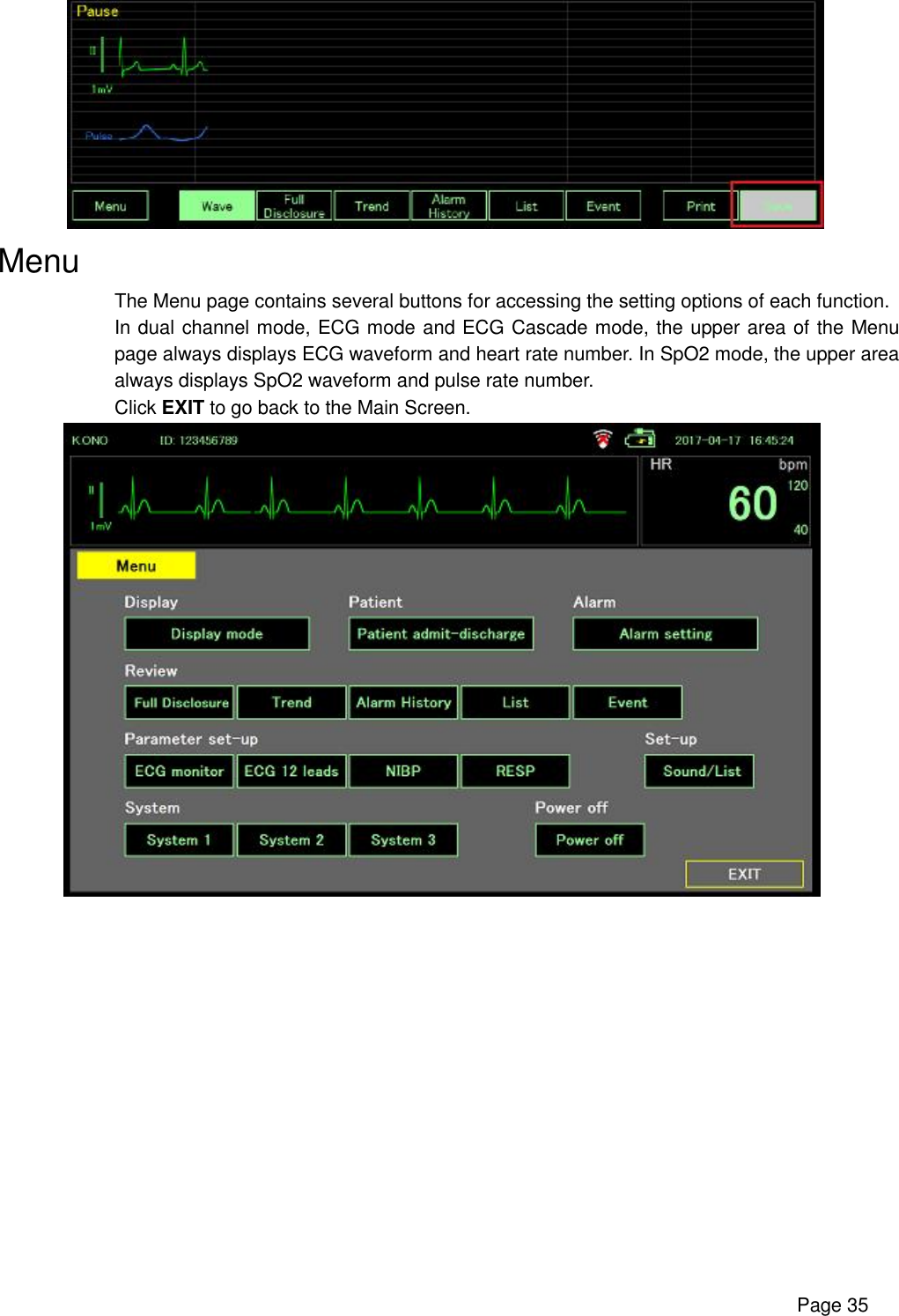      Page 35   Menu The Menu page contains several buttons for accessing the setting options of each function. In dual channel mode, ECG mode and ECG Cascade mode, the upper area of the Menu page always displays ECG waveform and heart rate number. In SpO2 mode, the upper area always displays SpO2 waveform and pulse rate number. Click EXIT to go back to the Main Screen.    