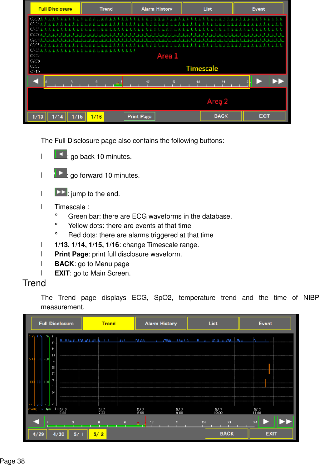    Page 38  The Full Disclosure page also contains the following buttons: l  : go back 10 minutes.  l : go forward 10 minutes. l  : jump to the end. l Timescale : ¡ Green bar: there are ECG waveforms in the database. ¡ Yellow dots: there are events at that time ¡ Red dots: there are alarms triggered at that time l 1/13, 1/14, 1/15, 1/16: change Timescale range. l Print Page: print full disclosure waveform. l BACK: go to Menu page l EXIT: go to Main Screen. Trend The Trend page displays ECG, SpO2, temperature trend and the time of NIBP measurement.  