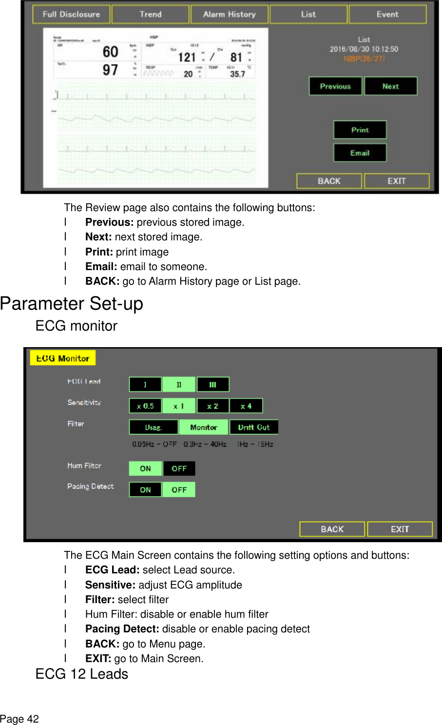    Page 42  The Review page also contains the following buttons: l Previous: previous stored image. l Next: next stored image. l Print: print image l Email: email to someone. l BACK: go to Alarm History page or List page. Parameter Set-up ECG monitor  The ECG Main Screen contains the following setting options and buttons: l ECG Lead: select Lead source. l Sensitive: adjust ECG amplitude l Filter: select filter l Hum Filter: disable or enable hum filter l Pacing Detect: disable or enable pacing detect l BACK: go to Menu page. l EXIT: go to Main Screen. ECG 12 Leads 