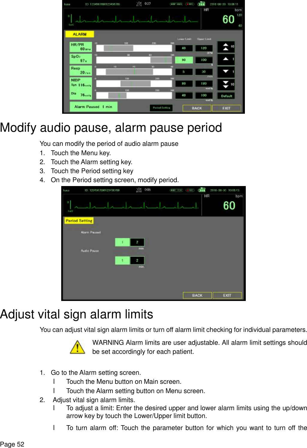    Page 52  Modify audio pause, alarm pause period You can modify the period of audio alarm pause 1. Touch the Menu key. 2. Touch the Alarm setting key. 3. Touch the Period setting key 4. On the Period setting screen, modify period.  Adjust vital sign alarm limits You can adjust vital sign alarm limits or turn off alarm limit checking for individual parameters.  WARNING Alarm limits are user adjustable. All alarm limit settings should be set accordingly for each patient.  1. Go to the Alarm setting screen. l Touch the Menu button on Main screen. l Touch the Alarm setting button on Menu screen. 2. Adjust vital sign alarm limits. l To adjust a limit: Enter the desired upper and lower alarm limits using the up/down arrow key by touch the Lower/Upper limit button. l To turn alarm off: Touch the parameter button for which you want to turn off the 