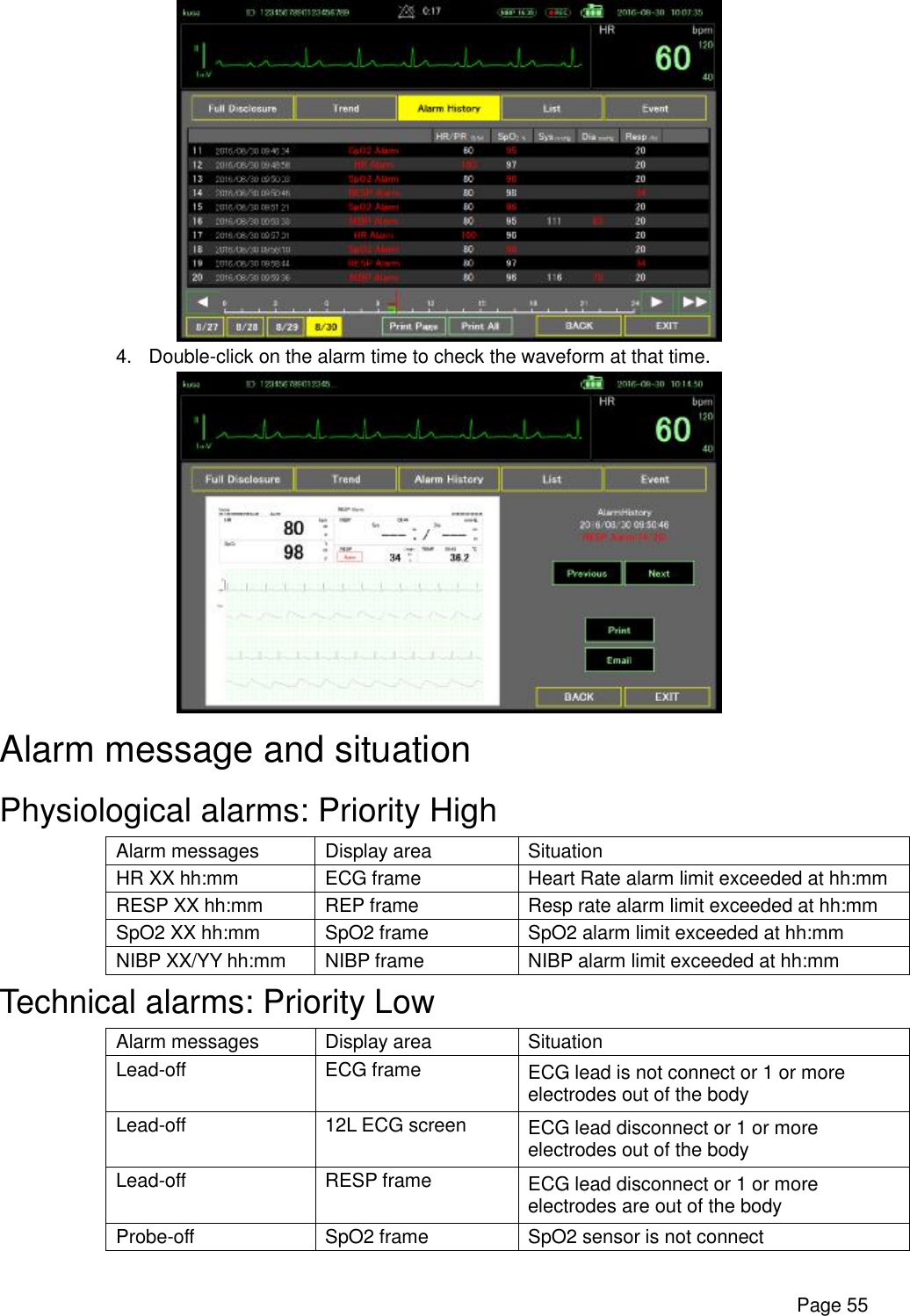      Page 55  4. Double-click on the alarm time to check the waveform at that time.  Alarm message and situation Physiological alarms: Priority High Alarm messages  Display area  Situation HR XX hh:mm  ECG frame  Heart Rate alarm limit exceeded at hh:mm RESP XX hh:mm  REP frame  Resp rate alarm limit exceeded at hh:mm SpO2 XX hh:mm  SpO2 frame  SpO2 alarm limit exceeded at hh:mm NIBP XX/YY hh:mm  NIBP frame  NIBP alarm limit exceeded at hh:mm Technical alarms: Priority Low Alarm messages  Display area  Situation Lead-off  ECG frame  ECG lead is not connect or 1 or more electrodes out of the body Lead-off  12L ECG screen  ECG lead disconnect or 1 or more electrodes out of the body Lead-off  RESP frame  ECG lead disconnect or 1 or more electrodes are out of the body Probe-off  SpO2 frame  SpO2 sensor is not connect 