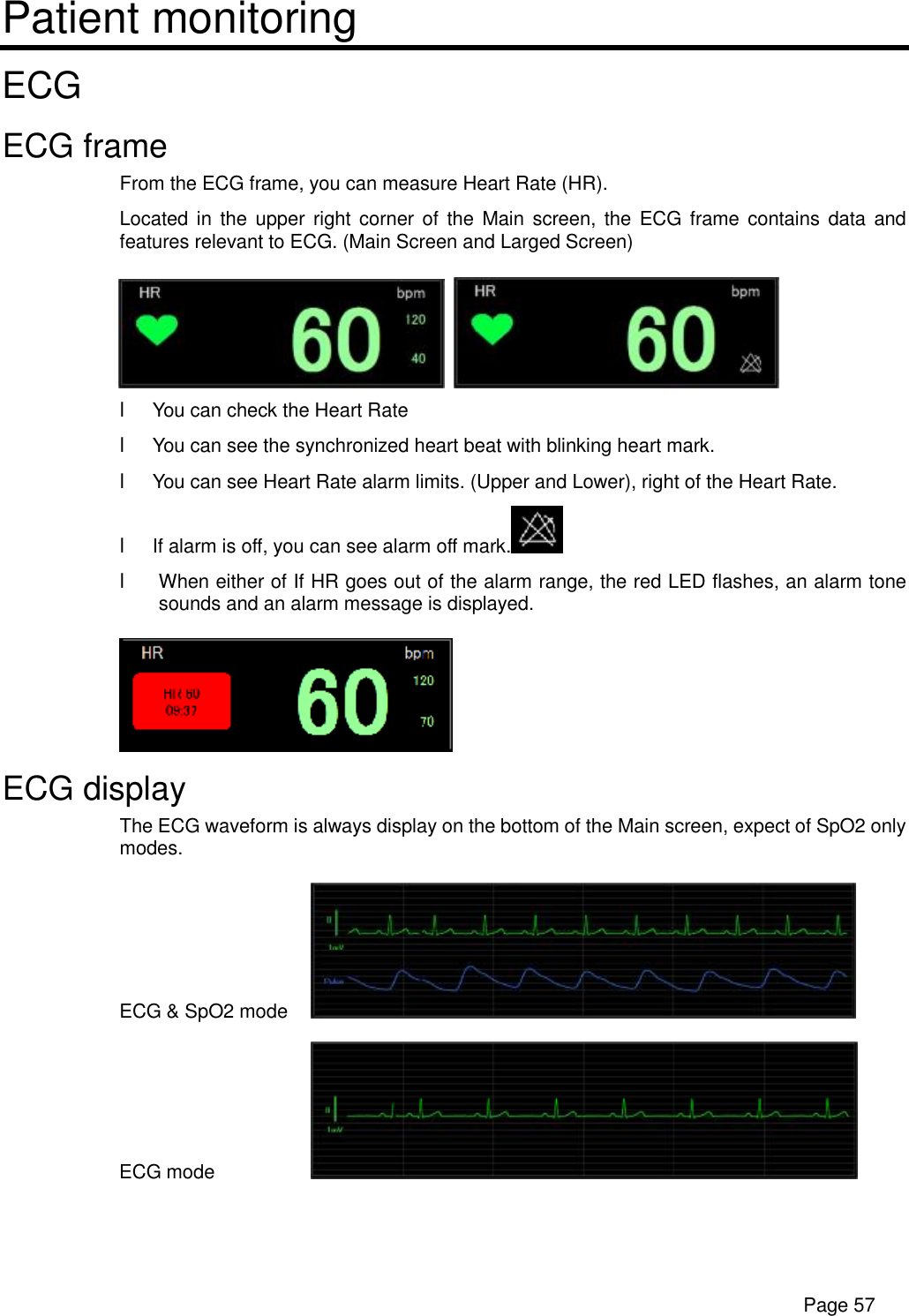      Page 57 Patient monitoring ECG ECG frame From the ECG frame, you can measure Heart Rate (HR). Located in the upper right corner of the Main screen, the ECG frame contains data and features relevant to ECG. (Main Screen and Larged Screen)    l You can check the Heart Rate l You can see the synchronized heart beat with blinking heart mark. l You can see Heart Rate alarm limits. (Upper and Lower), right of the Heart Rate. l If alarm is off, you can see alarm off mark.  l When either of If HR goes out of the alarm range, the red LED flashes, an alarm tone sounds and an alarm message is displayed.  ECG display The ECG waveform is always display on the bottom of the Main screen, expect of SpO2 only modes. ECG &amp; SpO2 mode    ECG mode     
