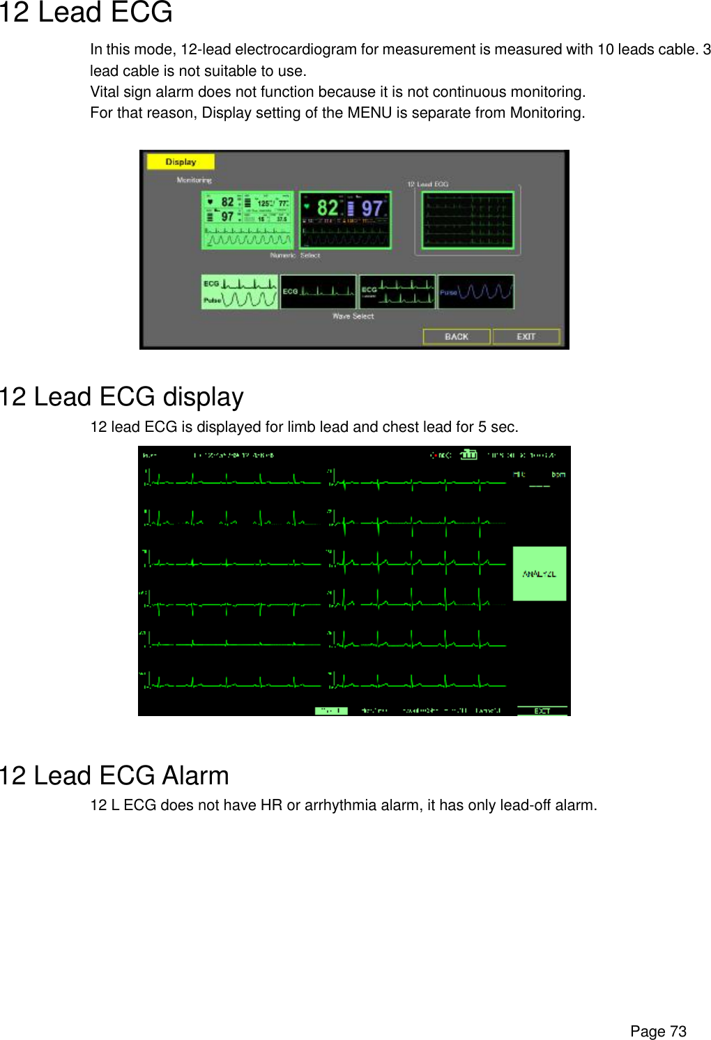      Page 73 12 Lead ECG In this mode, 12-lead electrocardiogram for measurement is measured with 10 leads cable. 3 lead cable is not suitable to use. Vital sign alarm does not function because it is not continuous monitoring. For that reason, Display setting of the MENU is separate from Monitoring.    12 Lead ECG display 12 lead ECG is displayed for limb lead and chest lead for 5 sec.   12 Lead ECG Alarm 12 L ECG does not have HR or arrhythmia alarm, it has only lead-off alarm. 