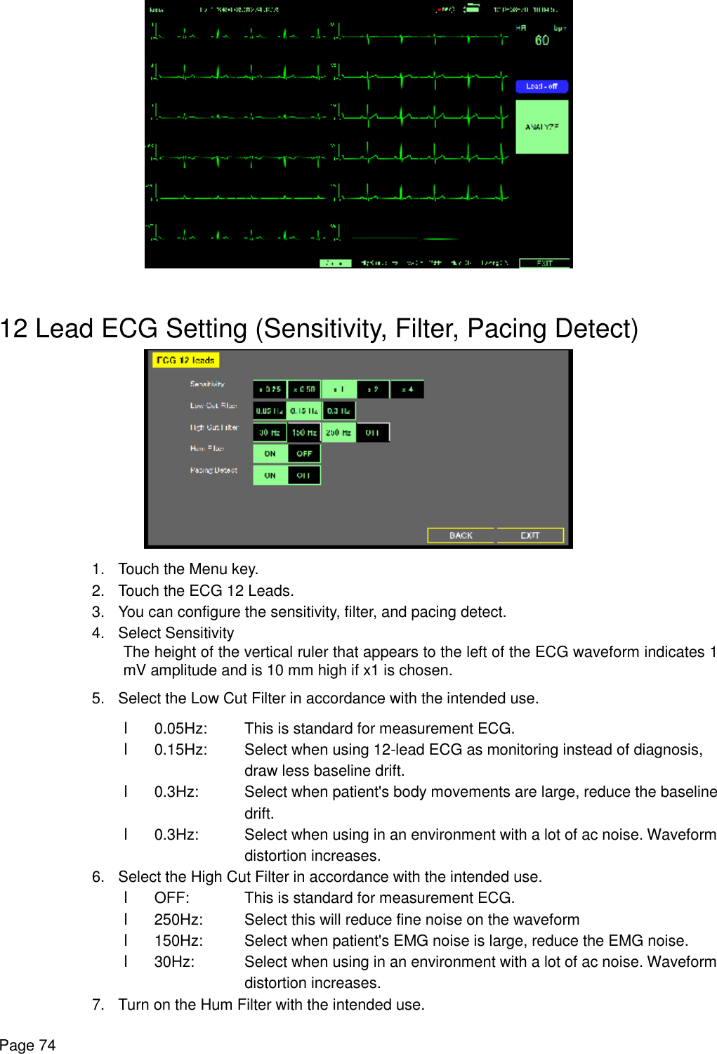    Page 74   12 Lead ECG Setting (Sensitivity, Filter, Pacing Detect)  1. Touch the Menu key. 2. Touch the ECG 12 Leads. 3. You can configure the sensitivity, filter, and pacing detect. 4. Select Sensitivity The height of the vertical ruler that appears to the left of the ECG waveform indicates 1 mV amplitude and is 10 mm high if x1 is chosen. 5. Select the Low Cut Filter in accordance with the intended use. l 0.05Hz:  This is standard for measurement ECG. l 0.15Hz: Select when using 12-lead ECG as monitoring instead of diagnosis,    draw less baseline drift. l 0.3Hz: Select when patient&apos;s body movements are large, reduce the baseline   drift. l 0.3Hz: Select when using in an environment with a lot of ac noise. Waveform    distortion increases. 6. Select the High Cut Filter in accordance with the intended use. l OFF:  This is standard for measurement ECG. l 250Hz: Select this will reduce fine noise on the waveform l 150Hz: Select when patient&apos;s EMG noise is large, reduce the EMG noise. l 30Hz: Select when using in an environment with a lot of ac noise. Waveform    distortion increases. 7. Turn on the Hum Filter with the intended use. 