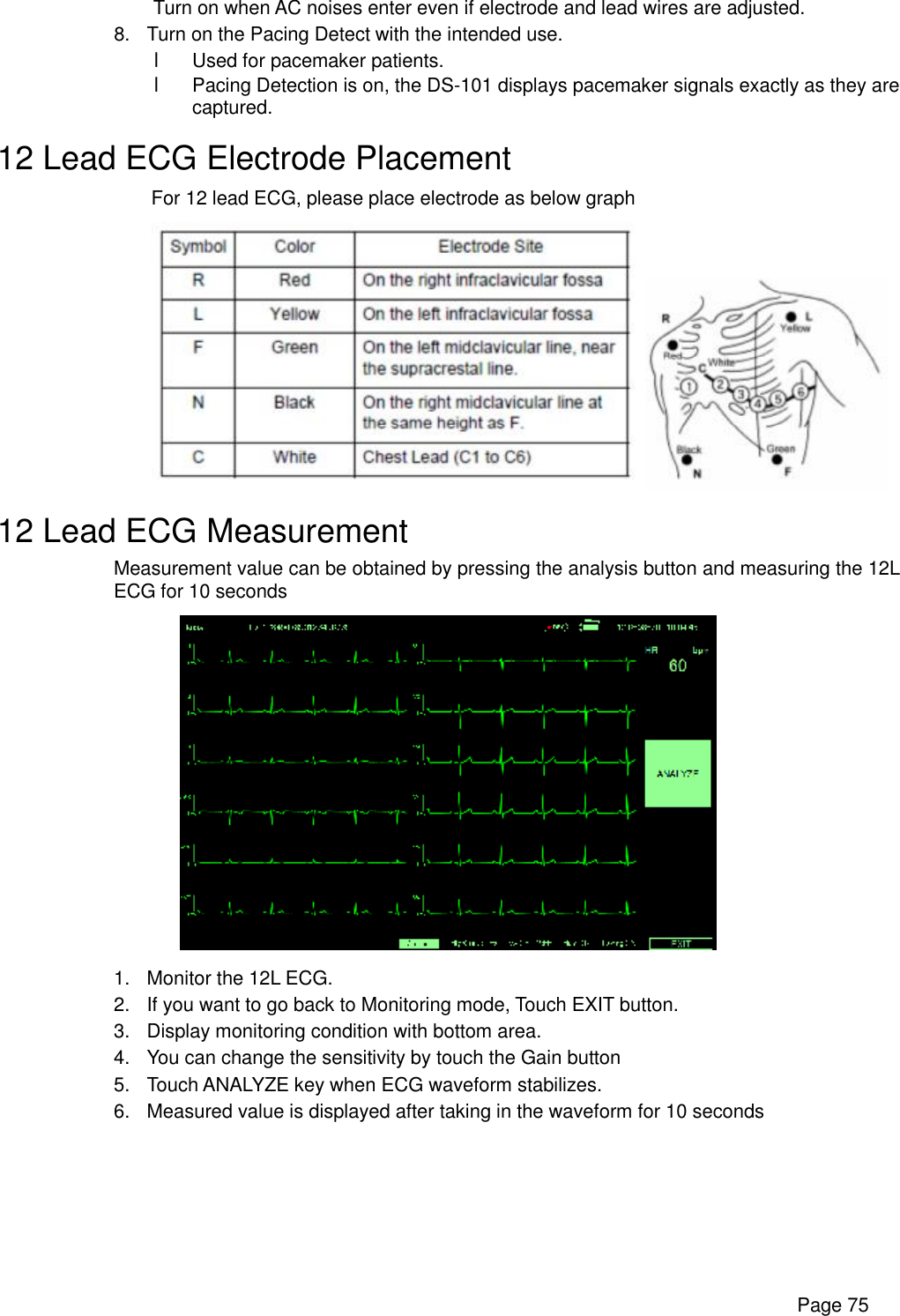      Page 75  Turn on when AC noises enter even if electrode and lead wires are adjusted. 8. Turn on the Pacing Detect with the intended use. l Used for pacemaker patients. l Pacing Detection is on, the DS-101 displays pacemaker signals exactly as they are captured. 12 Lead ECG Electrode Placement For 12 lead ECG, please place electrode as below graph  12 Lead ECG Measurement Measurement value can be obtained by pressing the analysis button and measuring the 12L ECG for 10 seconds  1. Monitor the 12L ECG. 2. If you want to go back to Monitoring mode, Touch EXIT button. 3. Display monitoring condition with bottom area. 4. You can change the sensitivity by touch the Gain button 5. Touch ANALYZE key when ECG waveform stabilizes. 6. Measured value is displayed after taking in the waveform for 10 seconds  