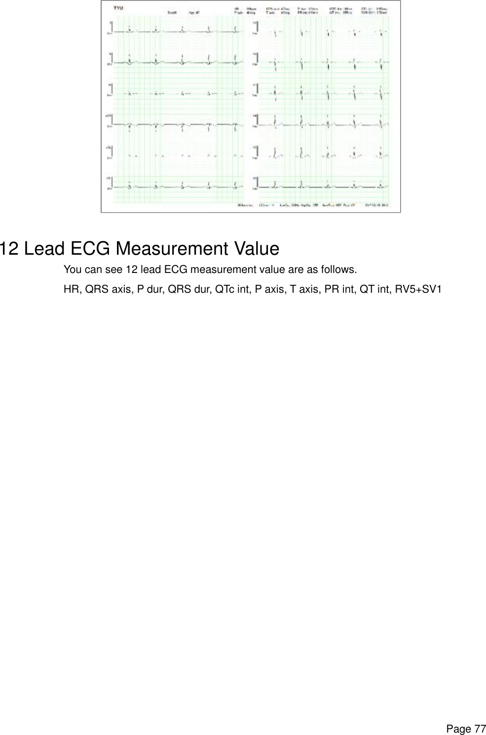      Page 77   12 Lead ECG Measurement Value You can see 12 lead ECG measurement value are as follows. HR, QRS axis, P dur, QRS dur, QTc int, P axis, T axis, PR int, QT int, RV5+SV1  