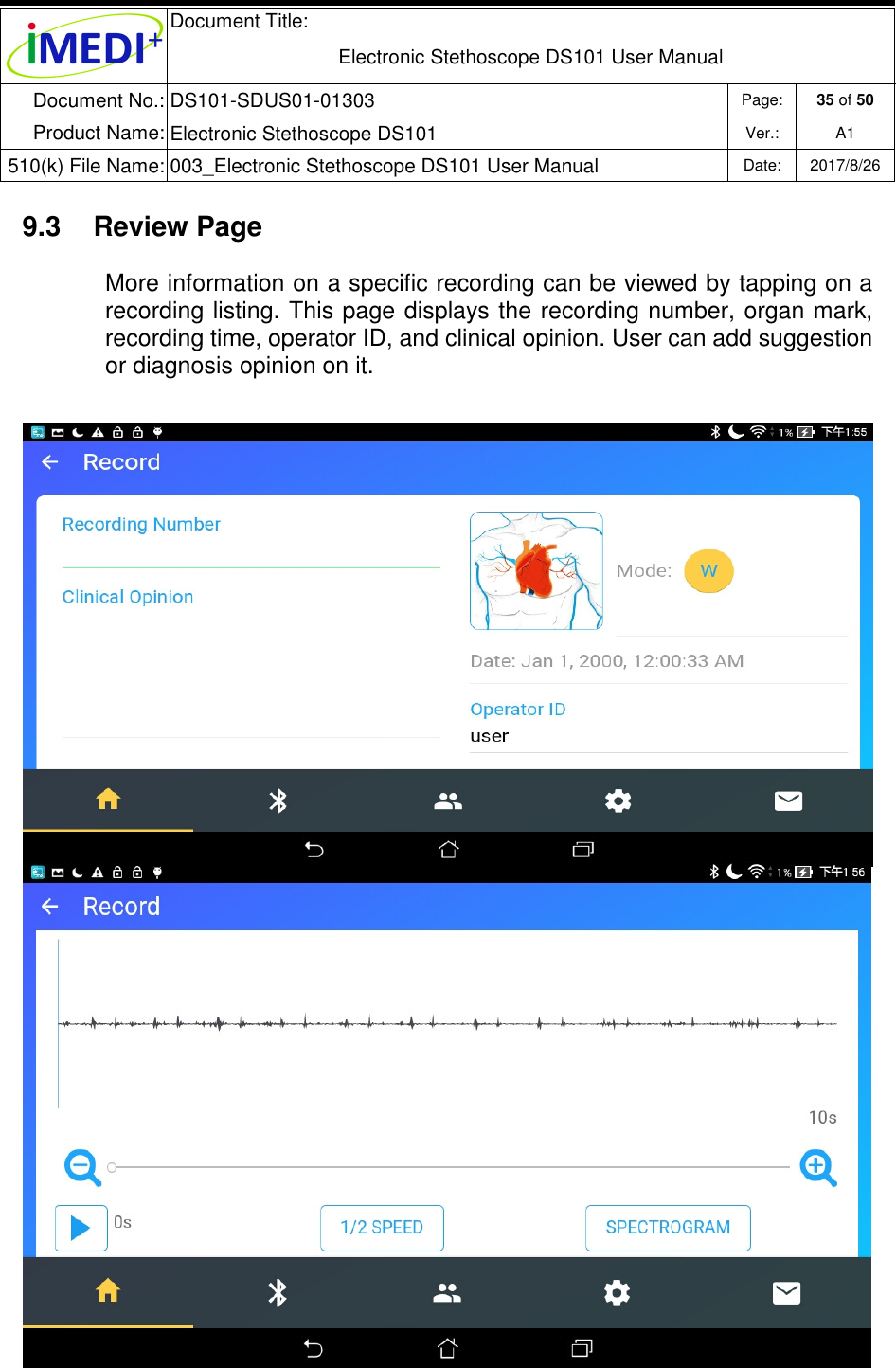  Document Title:  Electronic Stethoscope DS101 User Manual Document No.: DS101-SDUS01-01303 Page: 35 of 50 Product Name: Electronic Stethoscope DS101 Ver.: A1 510(k) File Name: 003_Electronic Stethoscope DS101 User Manual  Date: 2017/8/26   9.3  Review Page More information on a specific recording can be viewed by tapping on a recording listing. This page displays the recording number, organ mark, recording time, operator ID, and clinical opinion. User can add suggestion or diagnosis opinion on it. 