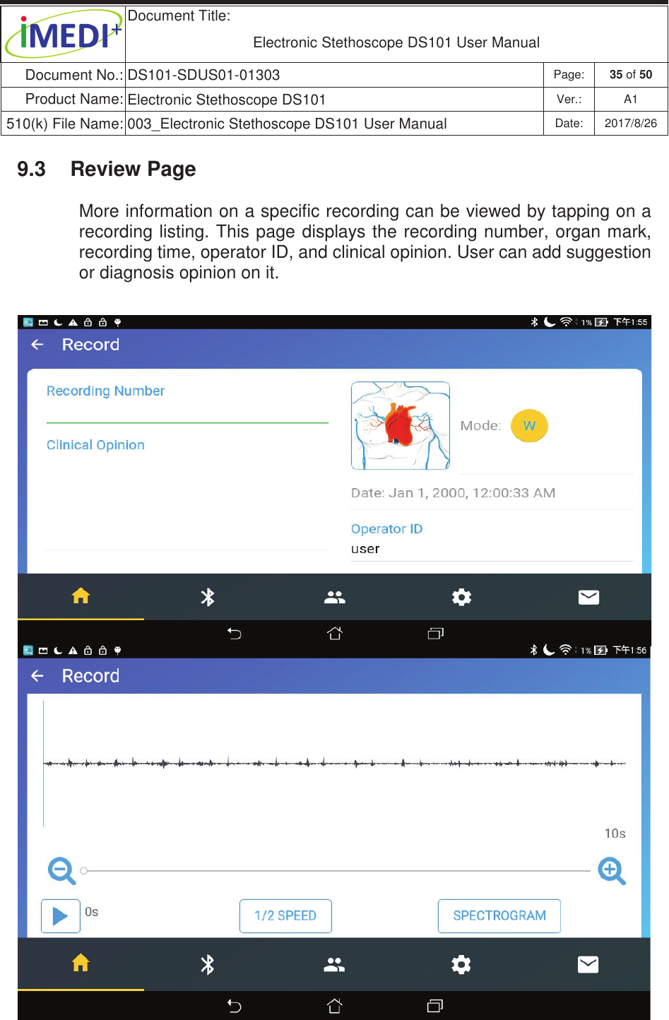  Document Title:  Electronic Stethoscope DS101 User Manual Document No.: DS101-SDUS01-01303 Page: 35 of 50 Product Name: Electronic Stethoscope DS101 Ver.: A1 510(k) File Name: 003_Electronic Stethoscope DS101 User Manual  Date: 2017/8/26 ġġ9.3  Review Page More information on a specific recording can be viewed by tapping on a recording listing. This page displays the recording number, organ mark, recording time, operator ID, and clinical opinion. User can add suggestion or diagnosis opinion on it. 