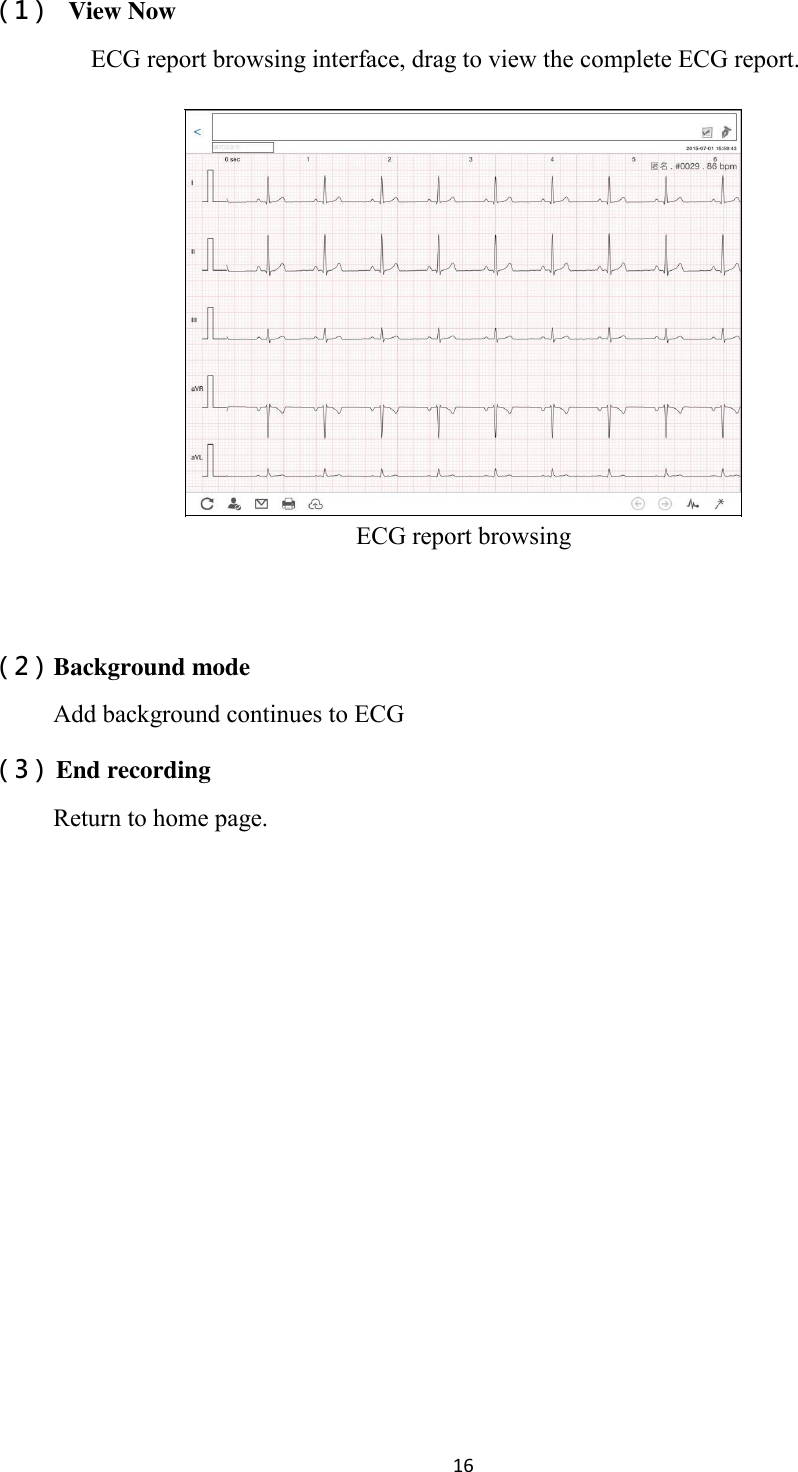 16  （1） View Now ECG report browsing interface, drag to view the complete ECG report.  ECG report browsing    （2） Background mode Add background continues to ECG （3） End recording Return to home page. 