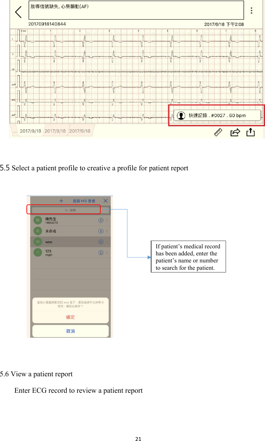 21      5.5 Select a patient profile to creative a profile for patient report       5.6 View a patient report  Enter ECG record to review a patient report If patient’s medical record has been added, enter the patient’s name or number to search for the patient. 