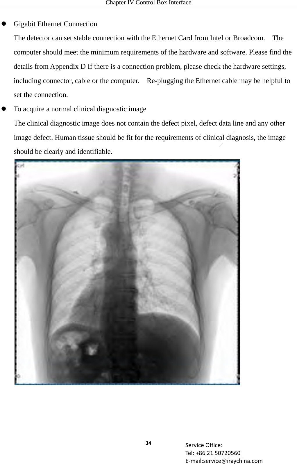 Chapter IV Control Box Interface 34 ServiceOffice:Tel:+862150720560E‐mail:service@iraychina.com Gigabit Ethernet Connection The detector can set stable connection with the Ethernet Card from Intel or Broadcom.    The computer should meet the minimum requirements of the hardware and software. Please find the details from Appendix D If there is a connection problem, please check the hardware settings, including connector, cable or the computer.    Re-plugging the Ethernet cable may be helpful to set the connection.  To acquire a normal clinical diagnostic image The clinical diagnostic image does not contain the defect pixel, defect data line and any other image defect. Human tissue should be fit for the requirements of clinical diagnosis, the image should be clearly and identifiable.    