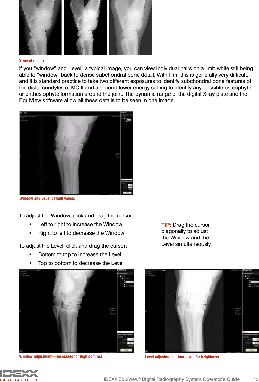   IDEXX EquiView® Digital Radiography System Operator’s Guide  15If you “window” and “level” a typical image, you can view individual hairs on a limb while still being able to “window” back to dense subchondral bone detail. With ﬁlm, this is generally very difﬁcult, and it is standard practice to take two different exposures to identify subchondral bone features of the distal condyles of MCIII and a second lower-energy setting to identify any possible osteophyte or enthesiophyte formation around the joint. The dynamic range of the digital X-ray plate and the EquiView software allow all these details to be seen in one image.To adjust the Window, click and drag the cursor:•  Left to right to increase the Window •  Right to left to decrease the WindowTo adjust the Level, click and drag the cursor:•  Bottom to top to increase the Level •  Top to bottom to decrease the Level Window and Level default valuesWindow adjustment—increased for high contrast Level adjustment—increased for brightnessX ray of a hockTIP: Drag the cursor diagonally to adjust the Window and the Level simultaneously.