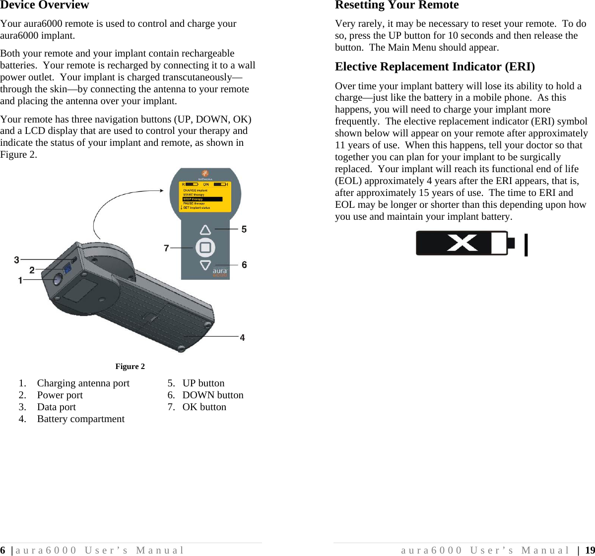 6 | aura6000 User’s Manual Device Overview Your aura6000 remote is used to control and charge your aura6000 implant. Both your remote and your implant contain rechargeable batteries.  Your remote is recharged by connecting it to a wall power outlet.  Your implant is charged transcutaneously—through the skin—by connecting the antenna to your remote and placing the antenna over your implant. Your remote has three navigation buttons (UP, DOWN, OK) and a LCD display that are used to control your therapy and indicate the status of your implant and remote, as shown in Figure 2.  Figure 2 1. Charging antenna port  5.  UP button 2. Power port  6.  DOWN button 3. Data port  7.  OK button 4. Battery compartment aura6000 User’s Manual | 19 Resetting Your Remote Very rarely, it may be necessary to reset your remote.  To do so, press the UP button for 10 seconds and then release the button.  The Main Menu should appear. Elective Replacement Indicator (ERI) Over time your implant battery will lose its ability to hold a charge—just like the battery in a mobile phone.  As this happens, you will need to charge your implant more frequently.  The elective replacement indicator (ERI) symbol shown below will appear on your remote after approximately 11 years of use.  When this happens, tell your doctor so that together you can plan for your implant to be surgically replaced.  Your implant will reach its functional end of life (EOL) approximately 4 years after the ERI appears, that is, after approximately 15 years of use.  The time to ERI and EOL may be longer or shorter than this depending upon how you use and maintain your implant battery.  I