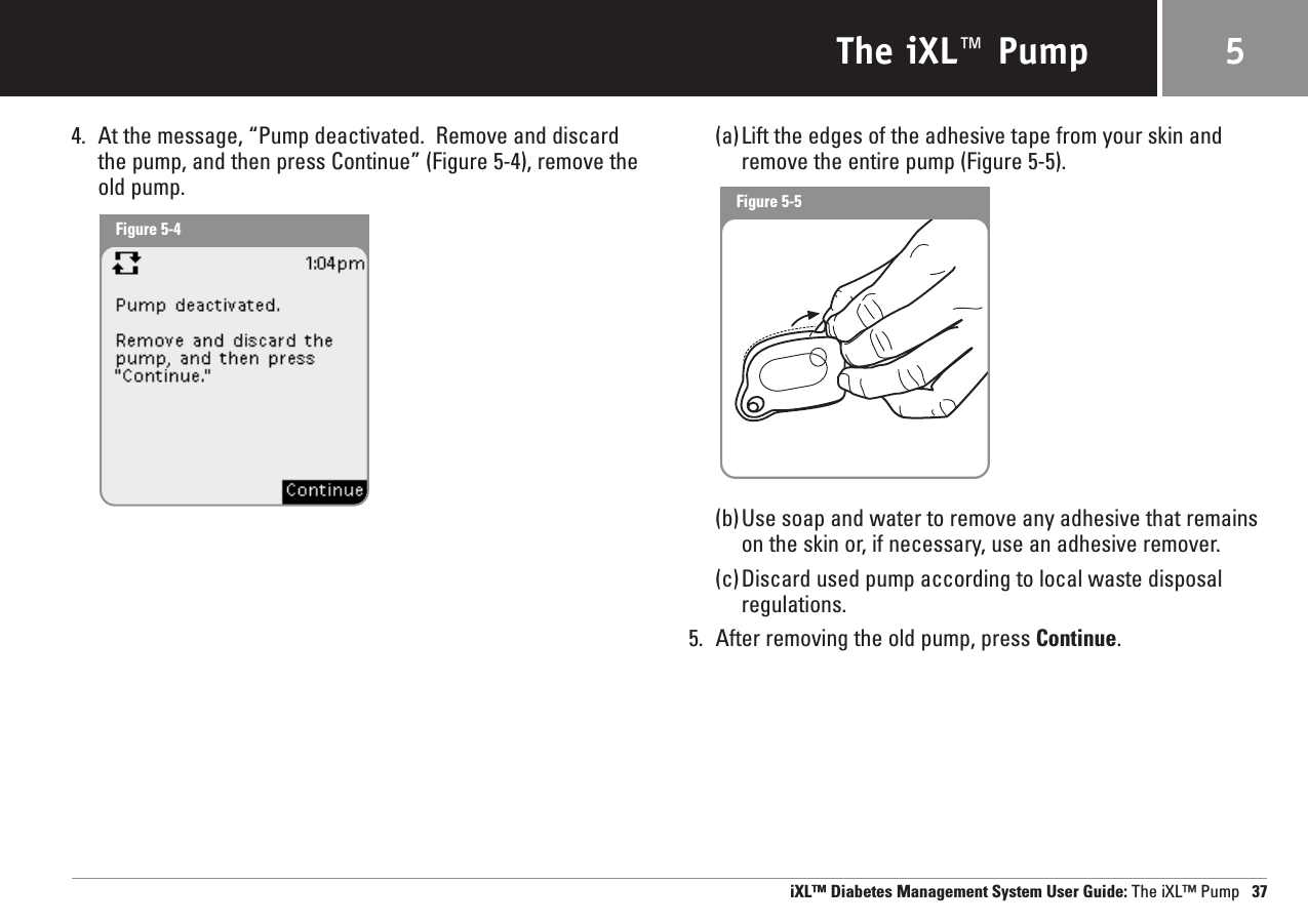 The iXL™ Pump4. At the message, “Pump deactivated.  Remove and discardthe pump, and then press Continue” (Figure 5-4), remove theold pump.(a)Lift the edges of the adhesive tape from your skin andremove the entire pump (Figure 5-5).(b)Use soap and water to remove any adhesive that remainson the skin or, if necessary, use an adhesive remover.(c)Discard used pump according to local waste disposalregulations.5. After removing the old pump, press Continue.iXL™ Diabetes Management System User Guide: The iXL™ Pump 375Figure 5-4Figure 5-5