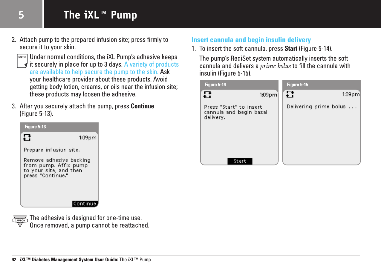 Figure 5-14 Figure 5-152. Attach pump to the prepared infusion site; press firmly tosecure it to your skin.Under normal conditions, the iXL Pump’s adhesive keepsit securely in place for up to 3 days. A variety of productsare available to help secure the pump to the skin. Askyour healthcare provider about these products. Avoidgetting body lotion, creams, or oils near the infusion site;these products may loosen the adhesive.3. After you securely attach the pump, press Continue(Figure 5-13).The adhesive is designed for one-time use. Once removed, a pump cannot be reattached.Insert cannula and begin insulin delivery1. To insert the soft cannula, press Start (Figure 5-14).The pump’s RediSet system automatically inserts the soft cannula and delivers a prime bolus to fill the cannula withinsulin (Figure 5-15).42   iXL™ Diabetes Management System User Guide: The iXL™ PumpThe iXL™ Pump5Figure 5-13