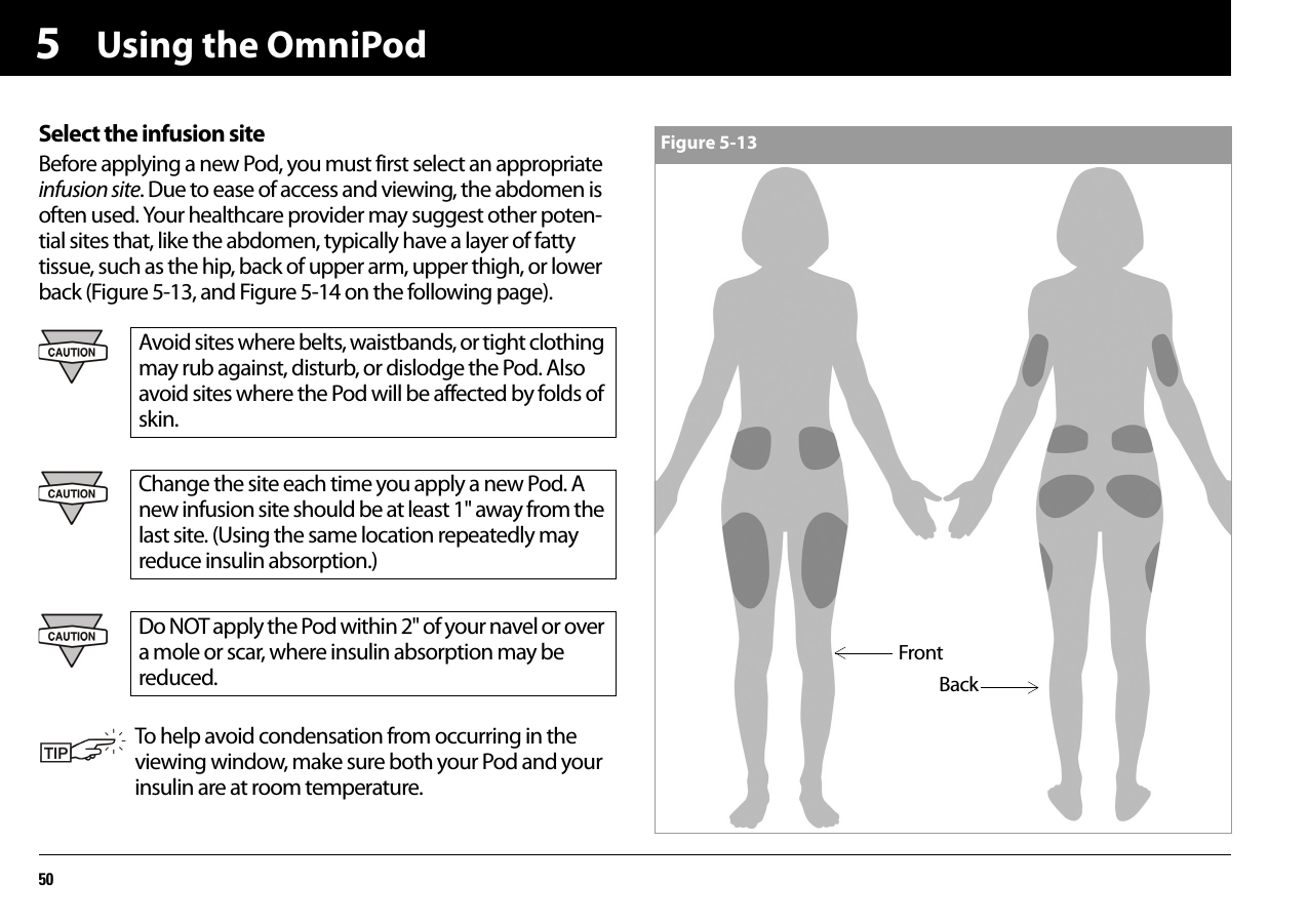 Using the OmniPod505Select the infusion siteBefore applying a new Pod, you must first select an appropriate infusion site. Due to ease of access and viewing, the abdomen is often used. Your healthcare provider may suggest other poten-tial sites that, like the abdomen, typically have a layer of fatty tissue, such as the hip, back of upper arm, upper thigh, or lower back (Figure 5-13, and Figure 5-14 on the following page).Avoid sites where belts, waistbands, or tight clothing may rub against, disturb, or dislodge the Pod. Also avoid sites where the Pod will be affected by folds of skin.Change the site each time you apply a new Pod. A new infusion site should be at least 1&quot; away from the last site. (Using the same location repeatedly may reduce insulin absorption.)Do NOT apply the Pod within 2&quot; of your navel or over a mole or scar, where insulin absorption may be reduced.To help avoid condensation from occurring in the viewing window, make sure both your Pod and your insulin are at room temperature.Figure 5-13FrontBack