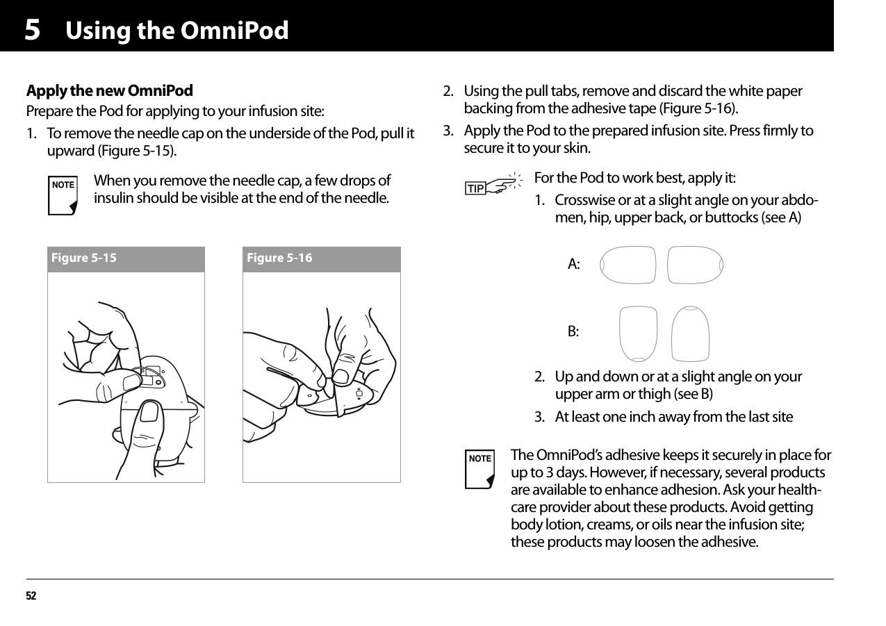 Using the OmniPod525Apply the new OmniPodPrepare the Pod for applying to your infusion site:1. To remove the needle cap on the underside of the Pod, pull it upward (Figure 5-15).2. Using the pull tabs, remove and discard the white paper backing from the adhesive tape (Figure 5-16).3. Apply the Pod to the prepared infusion site. Press firmly to secure it to your skin.When you remove the needle cap, a few drops of insulin should be visible at the end of the needle.Figure 5-15 Figure 5-16For the Pod to work best, apply it:1. Crosswise or at a slight angle on your abdo-men, hip, upper back, or buttocks (see A)2. Up and down or at a slight angle on your upper arm or thigh (see B)3. At least one inch away from the last siteThe OmniPod’s adhesive keeps it securely in place for up to 3 days. However, if necessary, several products are available to enhance adhesion. Ask your health-care provider about these products. Avoid getting body lotion, creams, or oils near the infusion site; these products may loosen the adhesive.A:B: